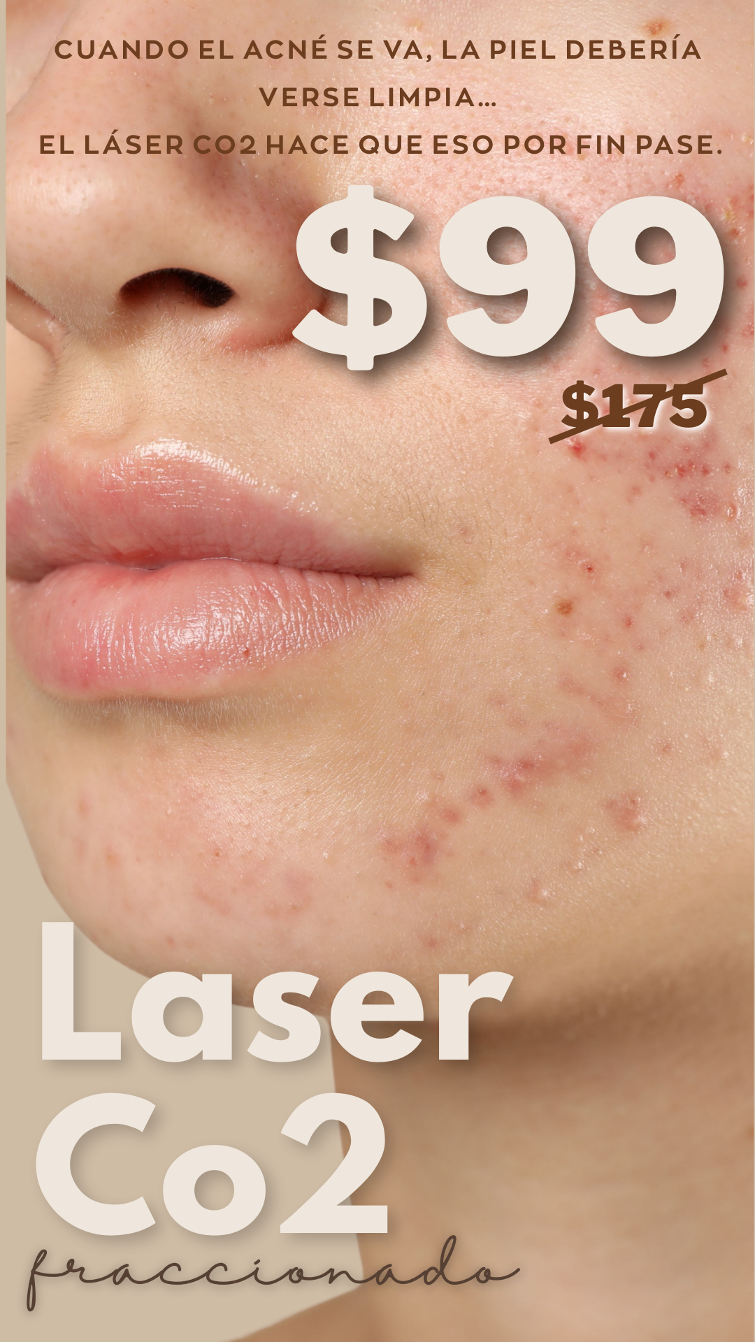 Sol Estetica MED Facebook ad from Mar 17, 2026