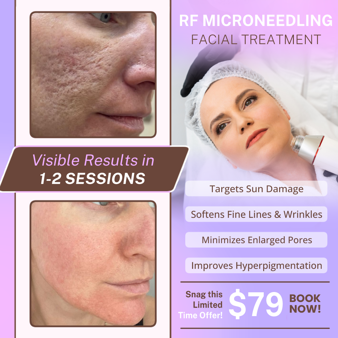 Love My Skin Treatments Facebook ad
