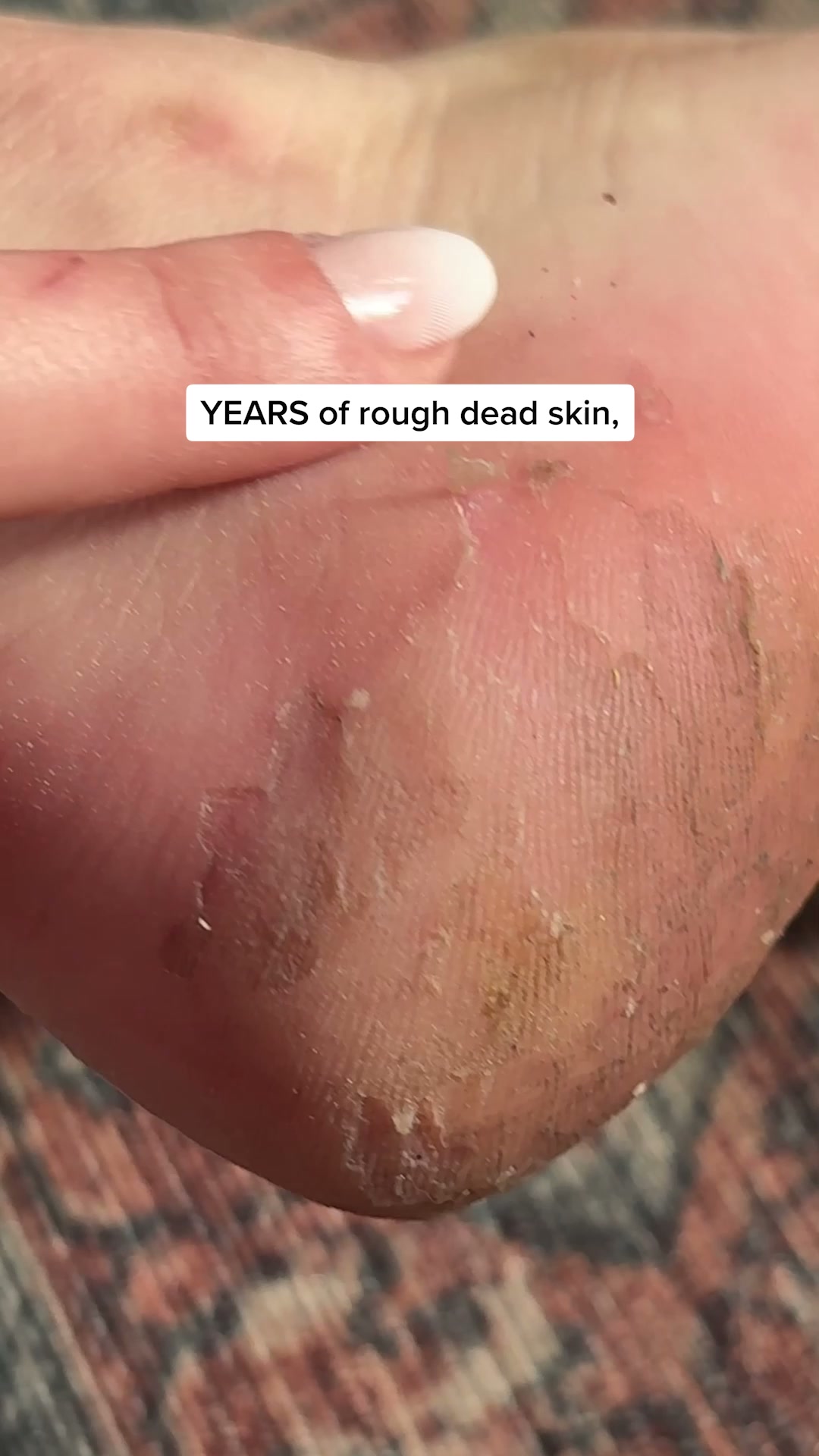 Skinmore Magazine Facebook ad: Smooth feet. In minutes. Guaranteed.