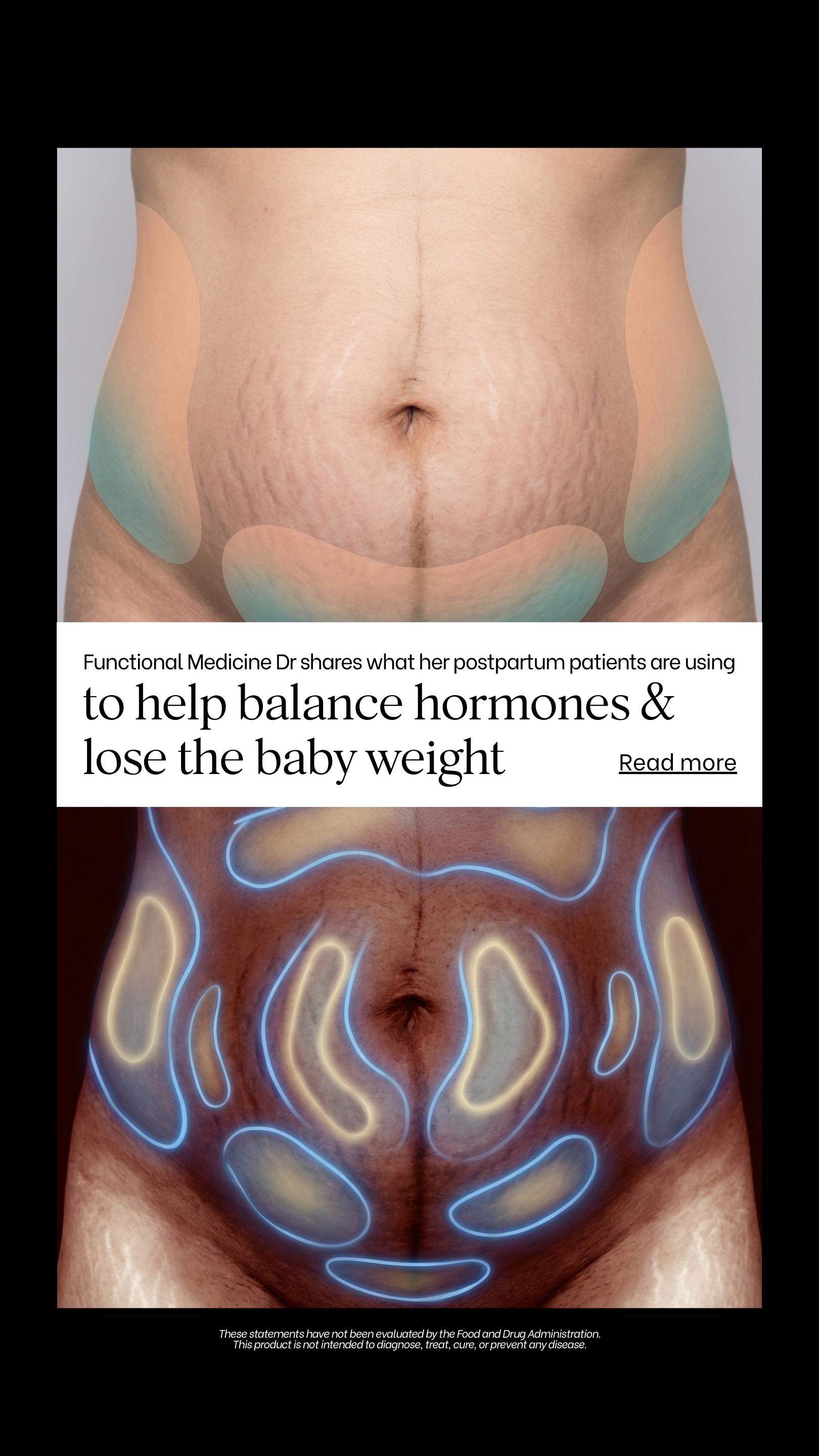 Zend Wellness Facebook ad: New Moms 30-Day Transformation