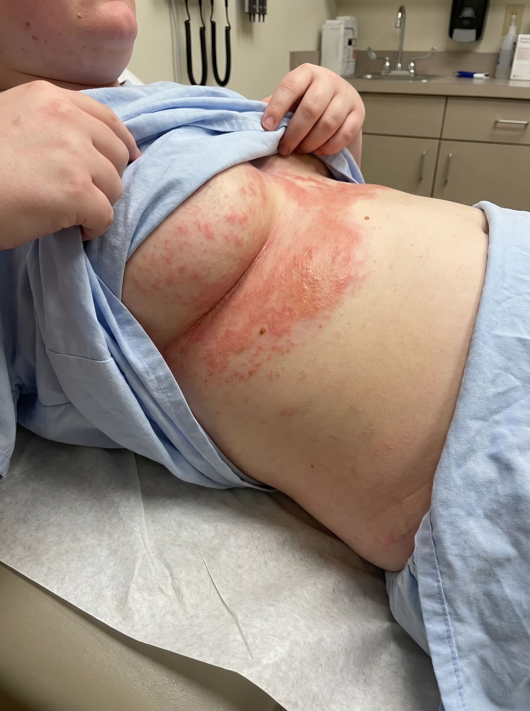 Her Health Hub Facebook ad: What Dermatologists WON'T Tell You About Underboob Rash