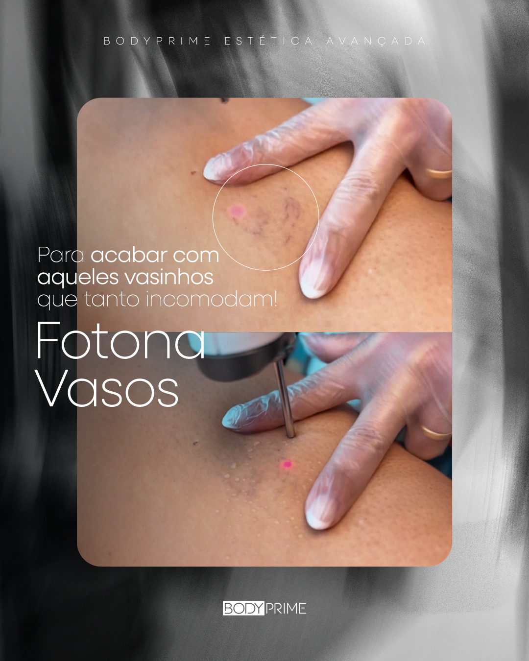 Bodyprime Leopoldo Menezes Facebook ad