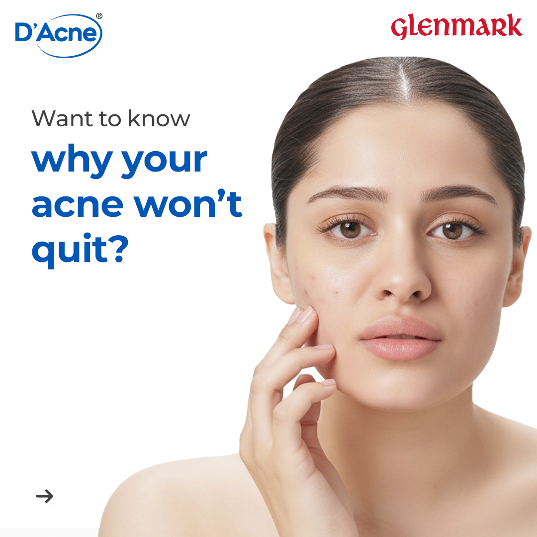 D'Acne by Glenmark Facebook ad: Acne does not stop at the surface.