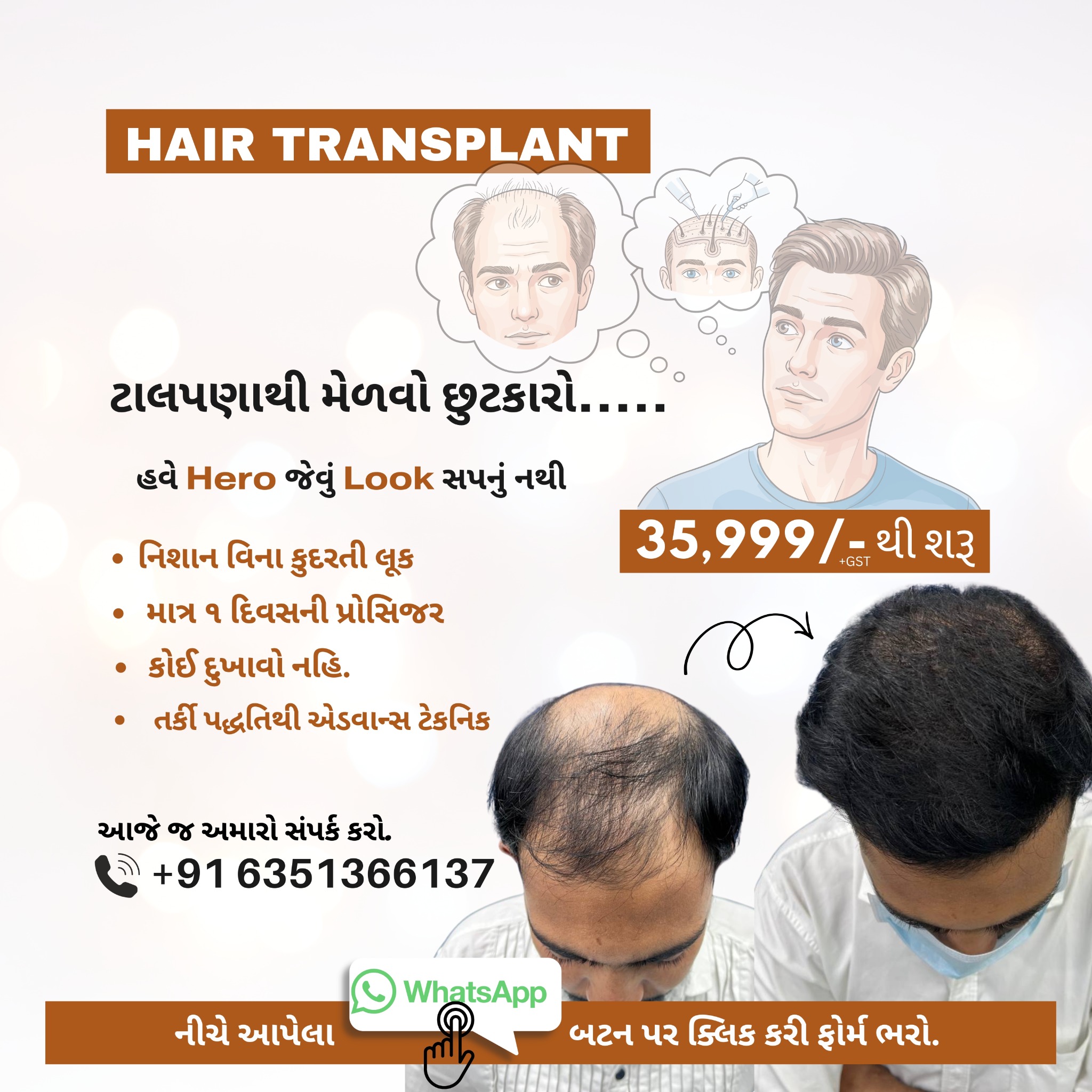 Advance Hair Transplant India Facebook ad from Jan 26, 2026