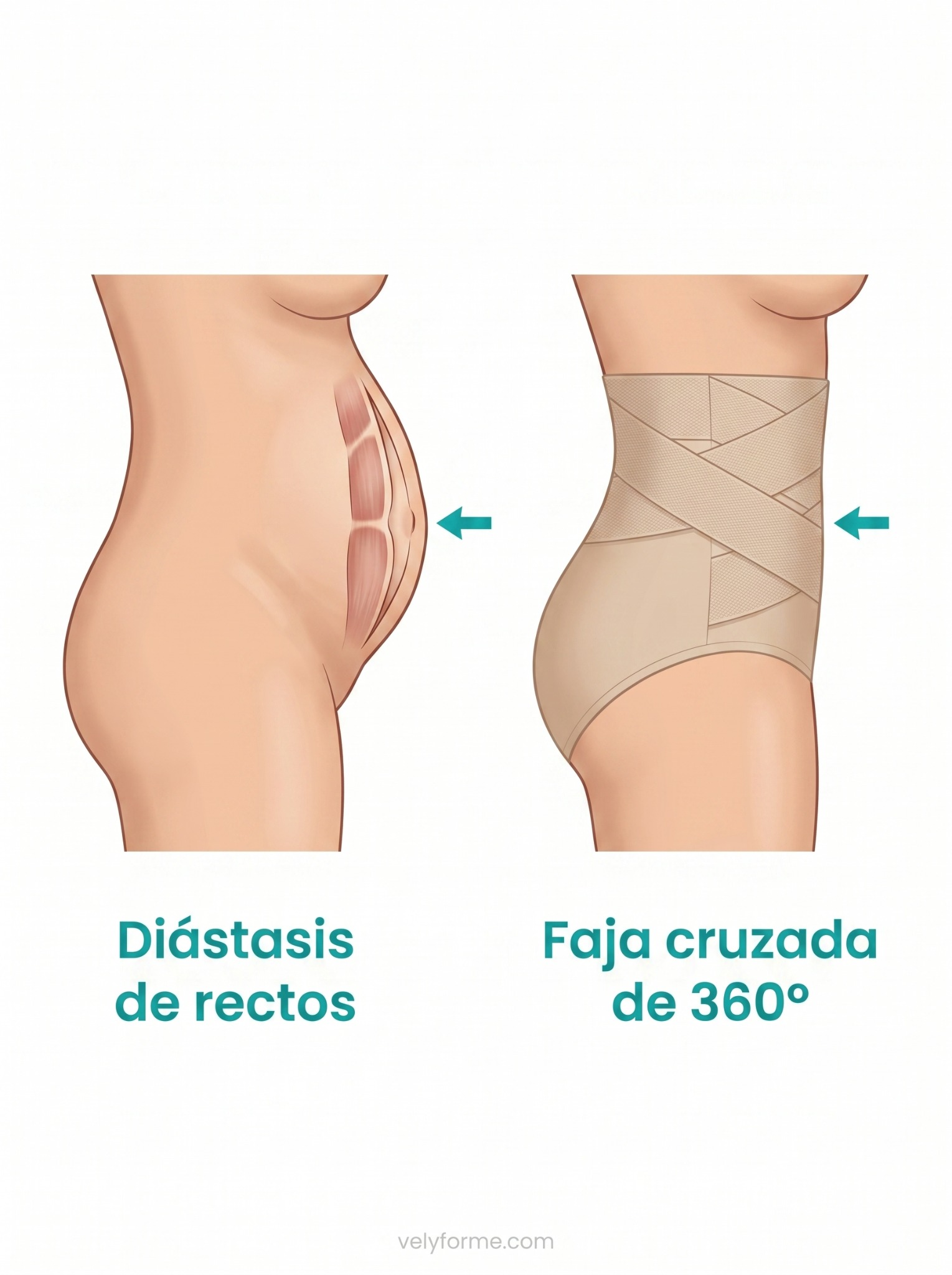 María Torres Ruiz Facebook ad: He gastado 1.935 € en 3 años para recuperar mi vientre…