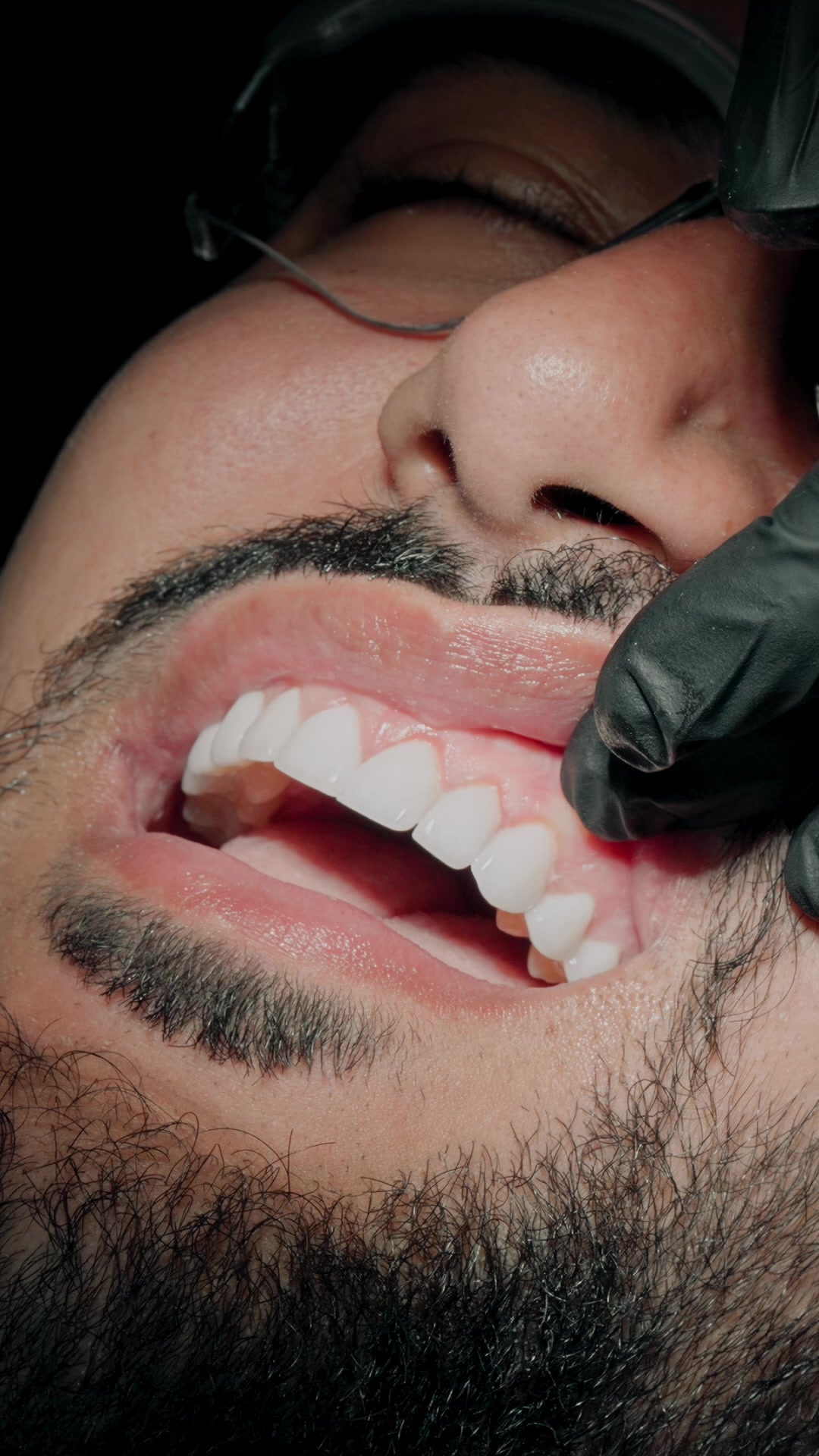 Dr.Laleh Mehrrafiee Facebook ad: The Secret To Celebrity Smiles!