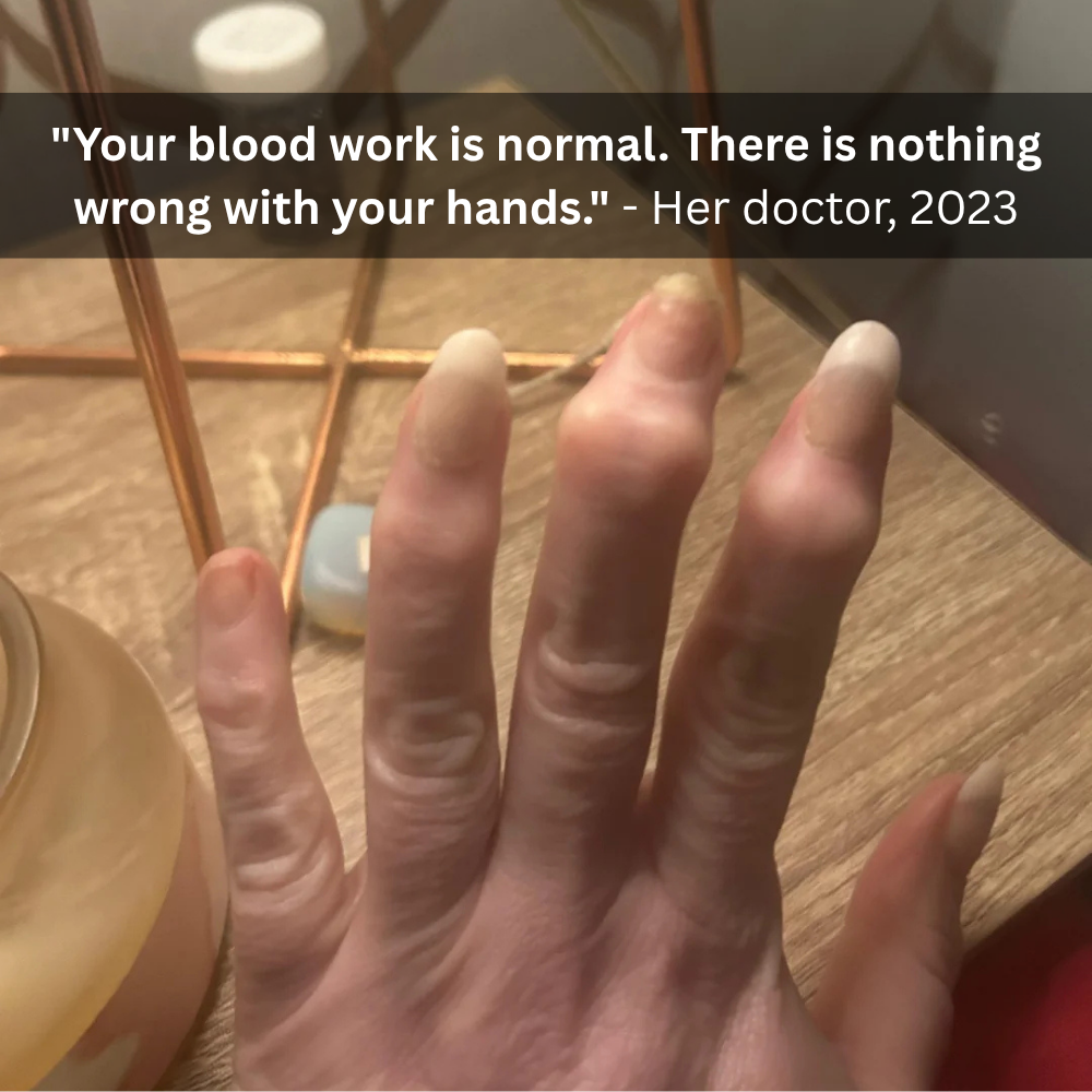 The Menopause Journal Facebook ad: Menopause did this to her hands