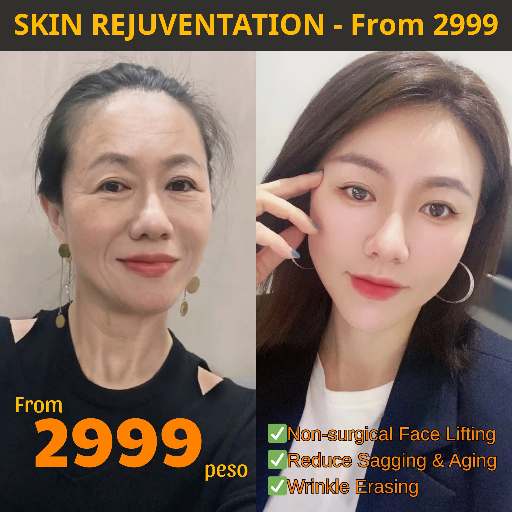 ADORA Beauty Center - Where beauty reigns Facebook ad: Disscount Up To 30% First 50 customers only