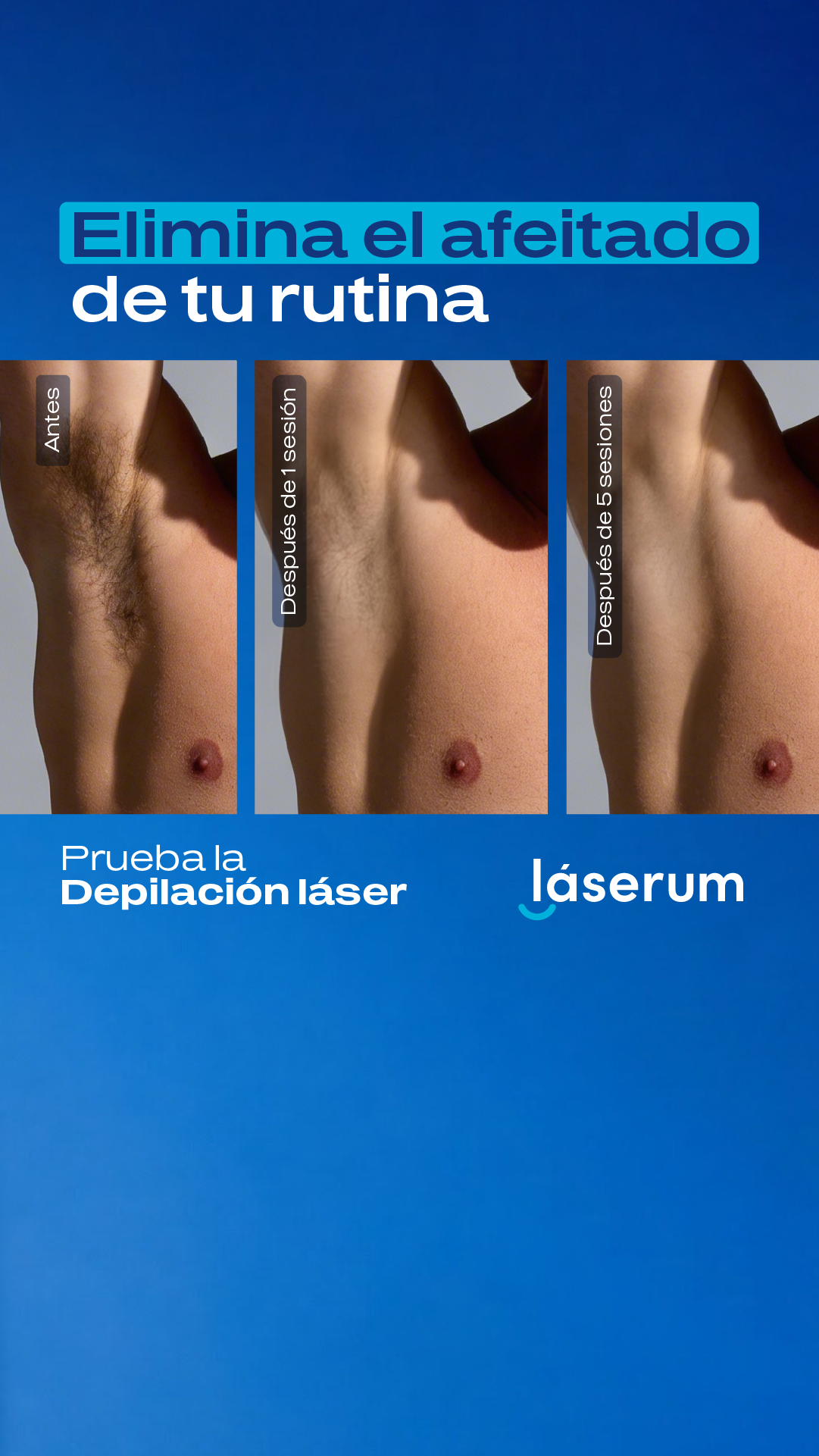Láserum Facebook ad