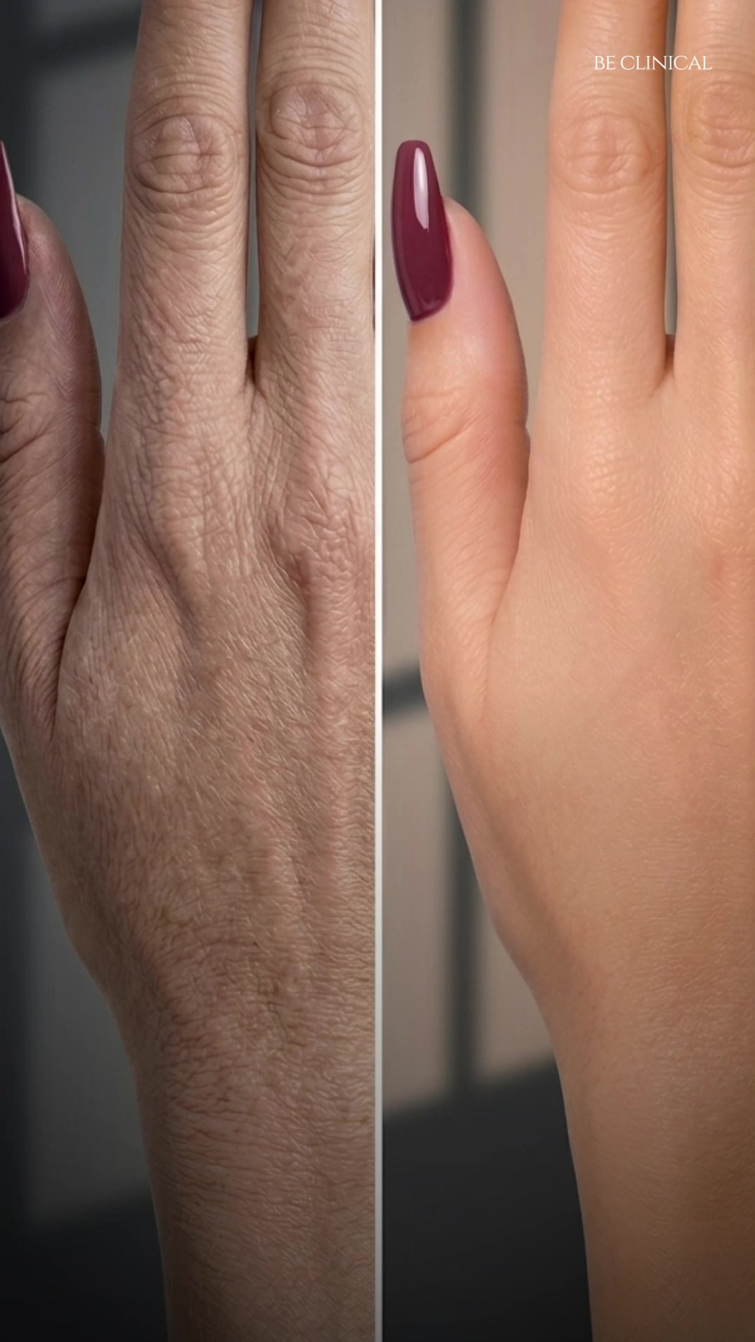 Be Clinical Facebook ad: Say Goodbye to Dry, Wrinkled Hands, Hello Youthful Softness!