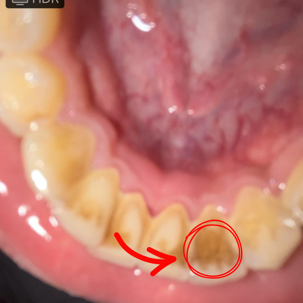 Dr. Amy Stanway Facebook ad: Whiter Teeth Now