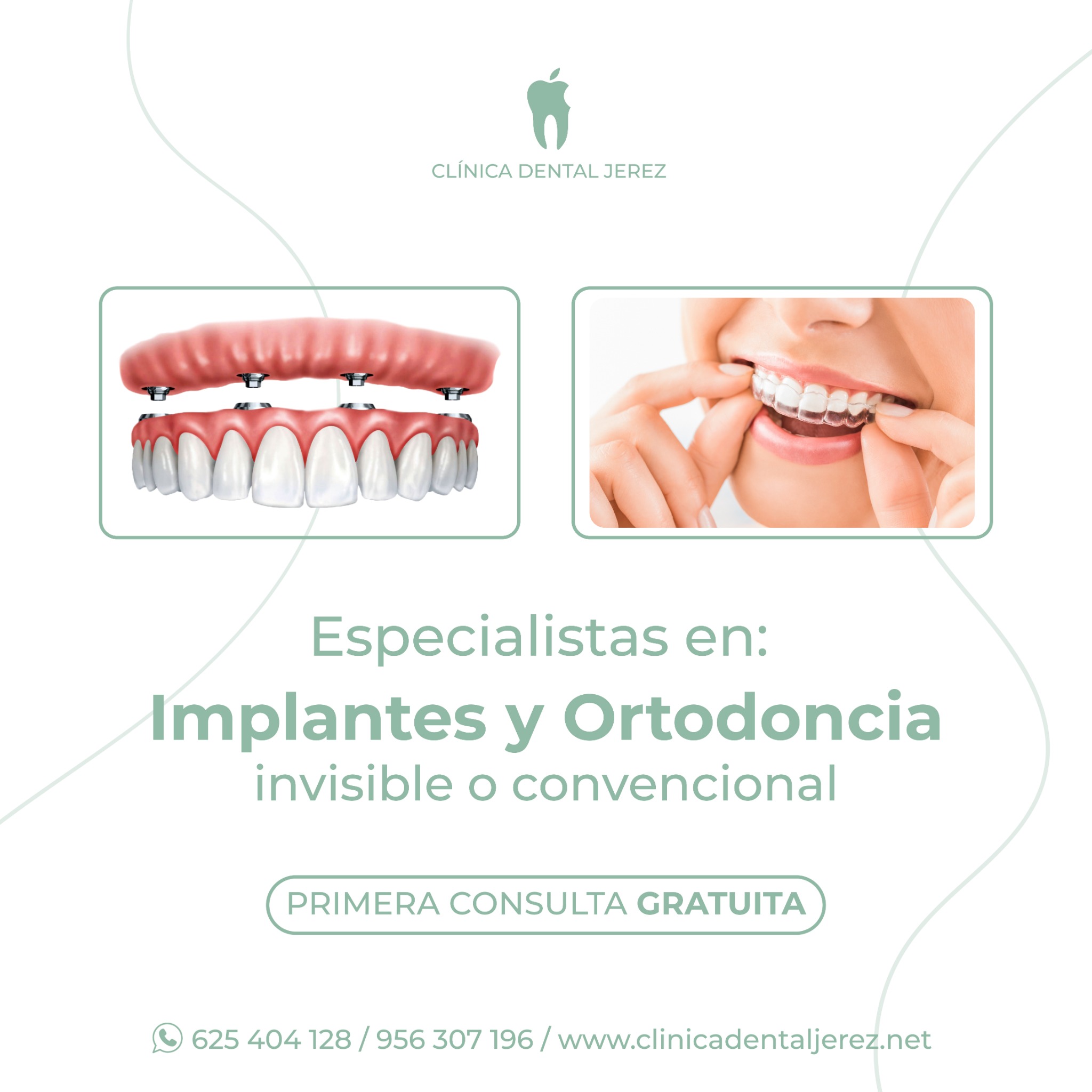 Clínica Dental Jerez Facebook ad: 1º Consulta Gratis