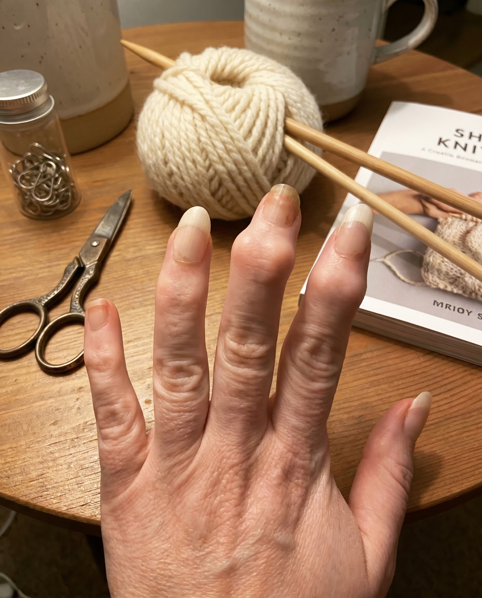 Dr Simmons, Hand Therapist Facebook ad: Has De Quervain's or Arthritis Made You Quit Knitting?
