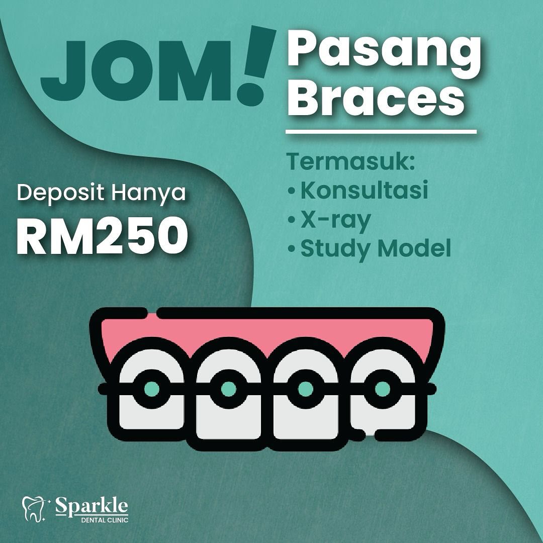 Klinik Pergigian Sparkle Shah Alam Facebook ad: Jom Pasang braces!