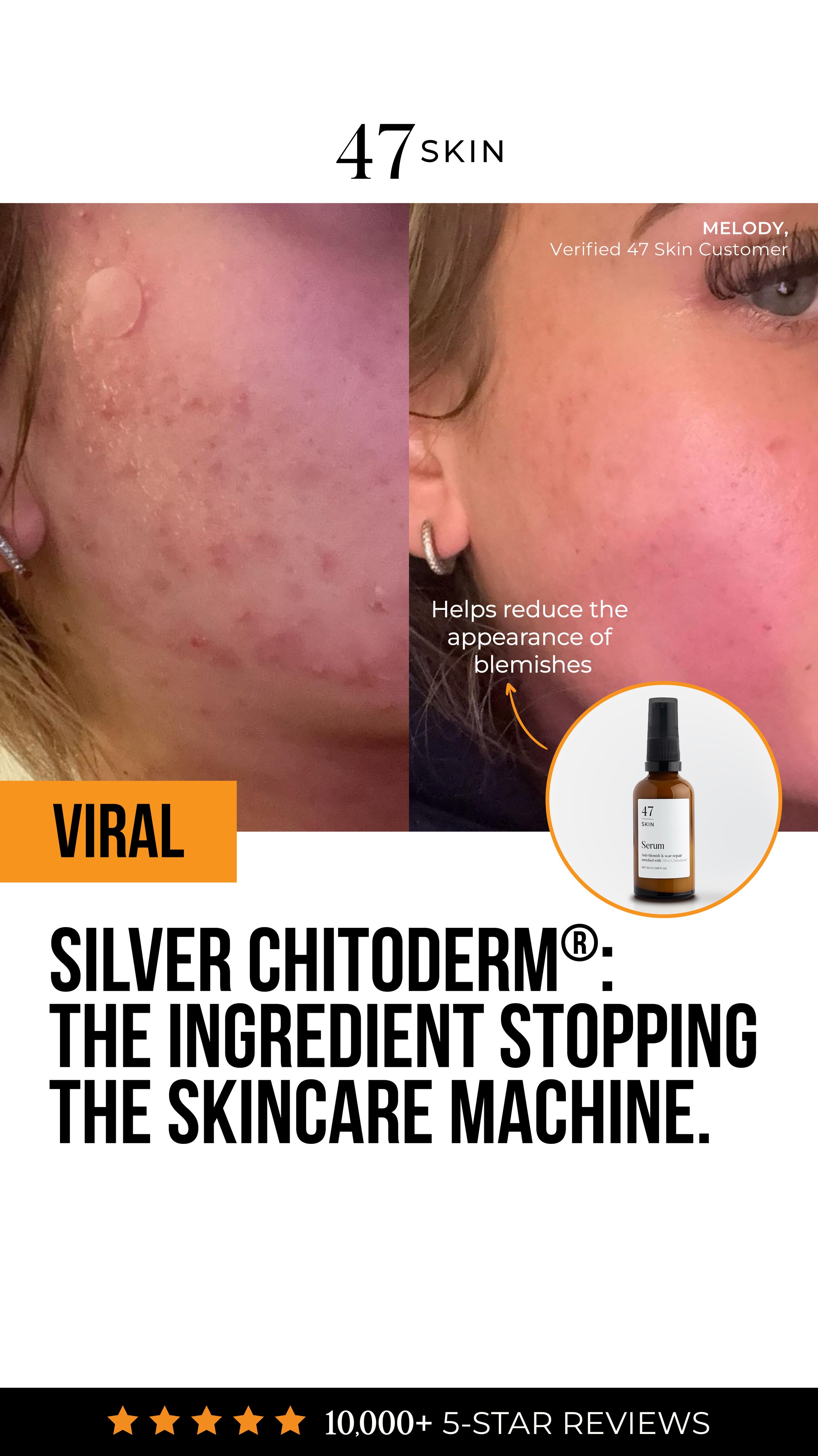 47Skin Facebook ad