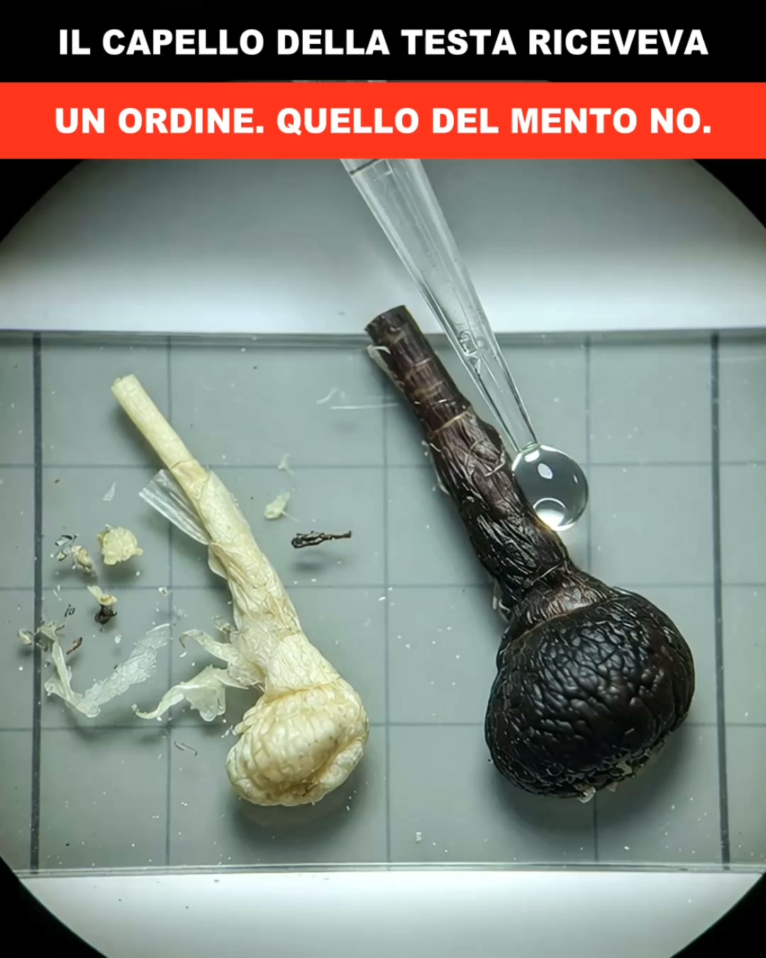 Scienza Salute & Benessere Facebook ad: Non era il DHT la causa del Diradamento.