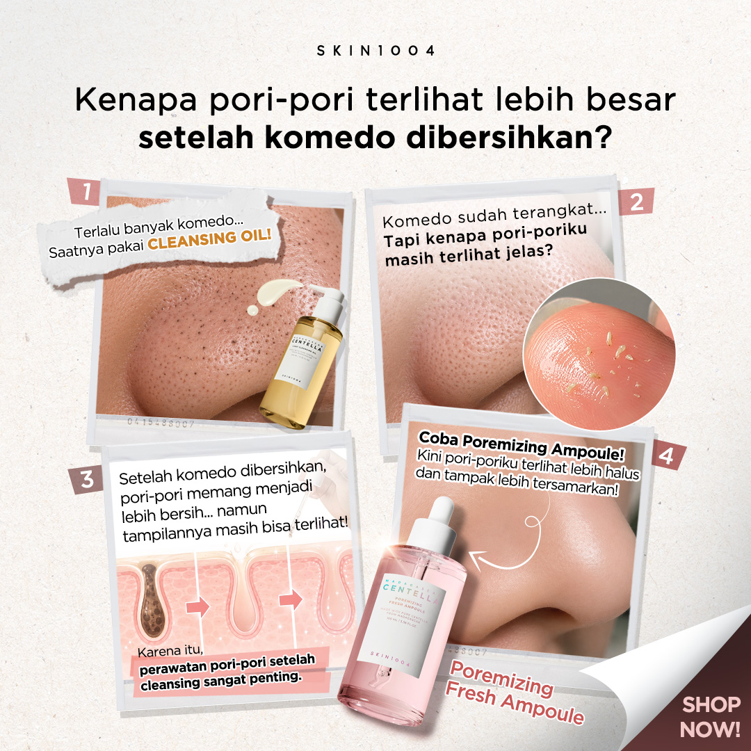 SKIN1004_Indonesia Facebook ad: Tingkatkan perawatan rutin pori-pori kamu