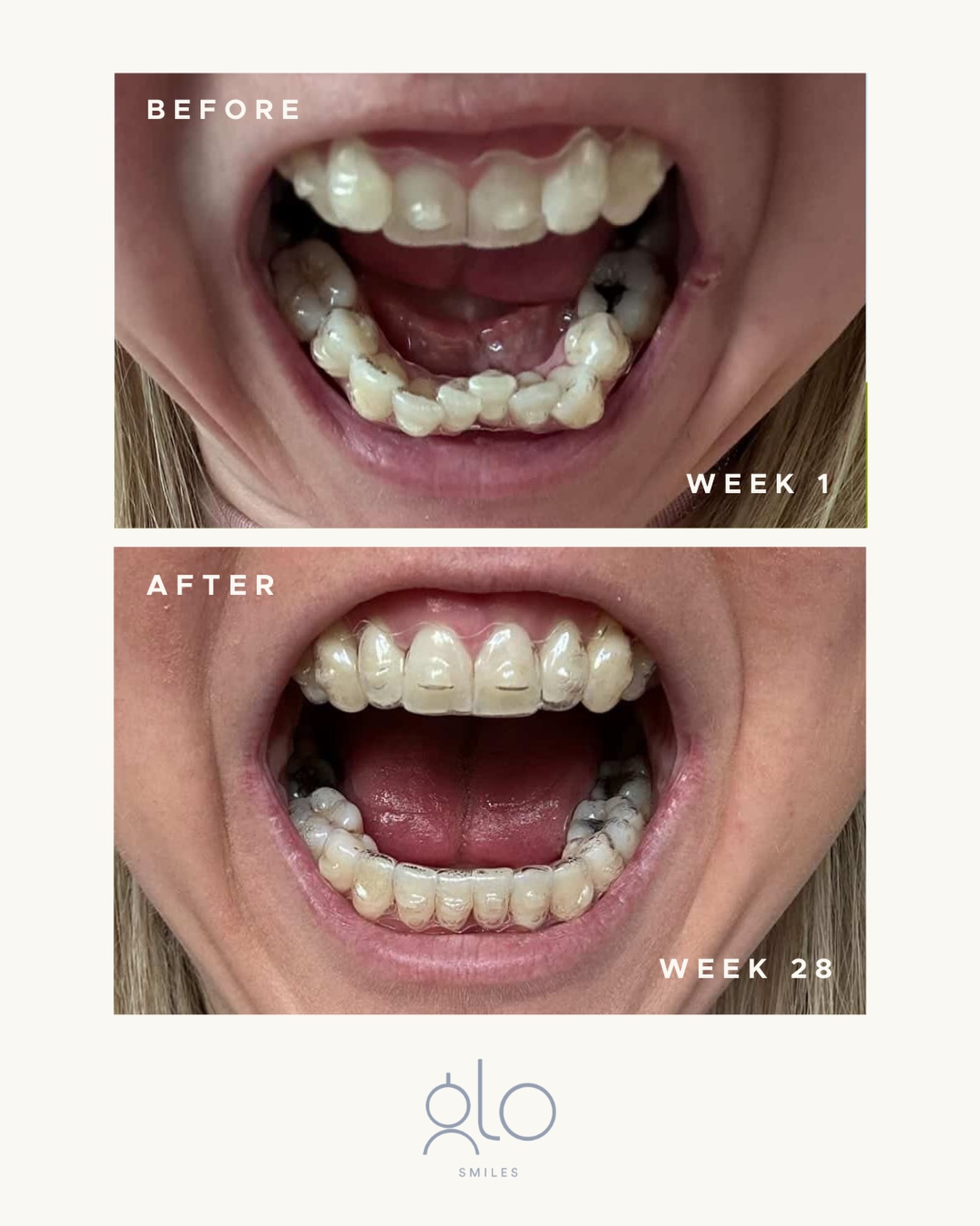 Ark Dentistry  Facebook ad