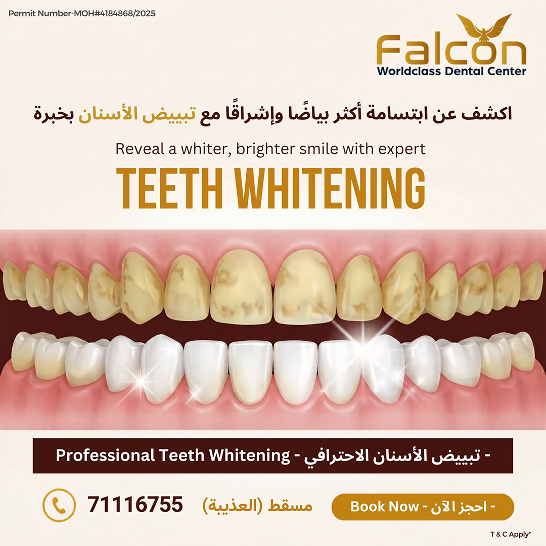 Falcon Dental Center Facebook ad: Professional Teeth Whitening