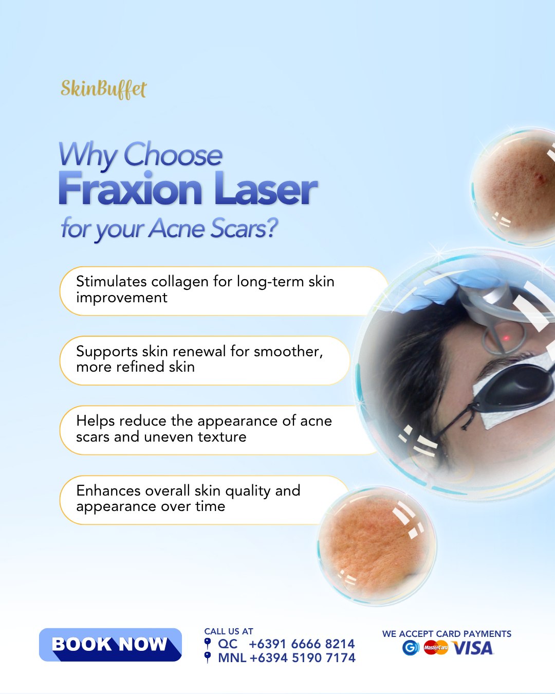 SkinBuffet Aesthetics Facebook ad