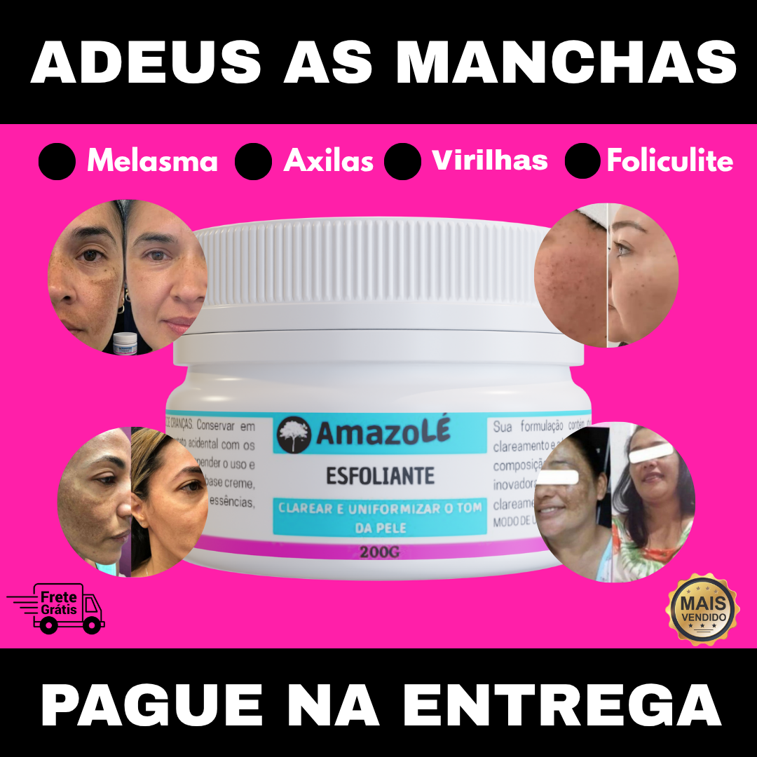 Amazon Kaps Store Facebook ad: PAGAMENTO NA ENTREGA