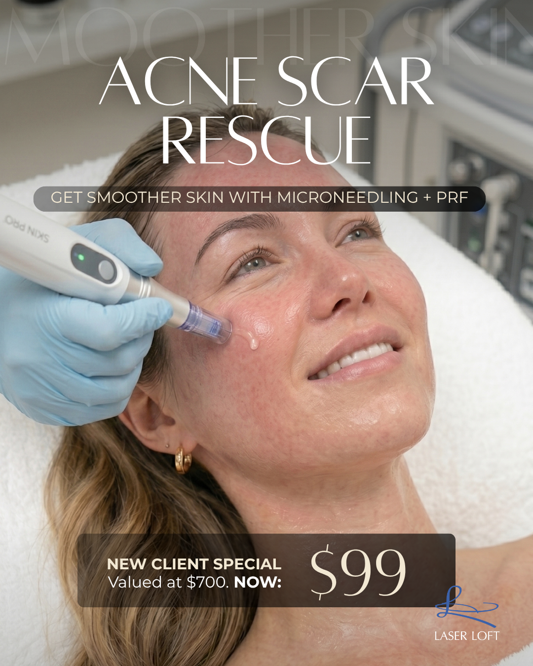 Laser Loft Facebook ad