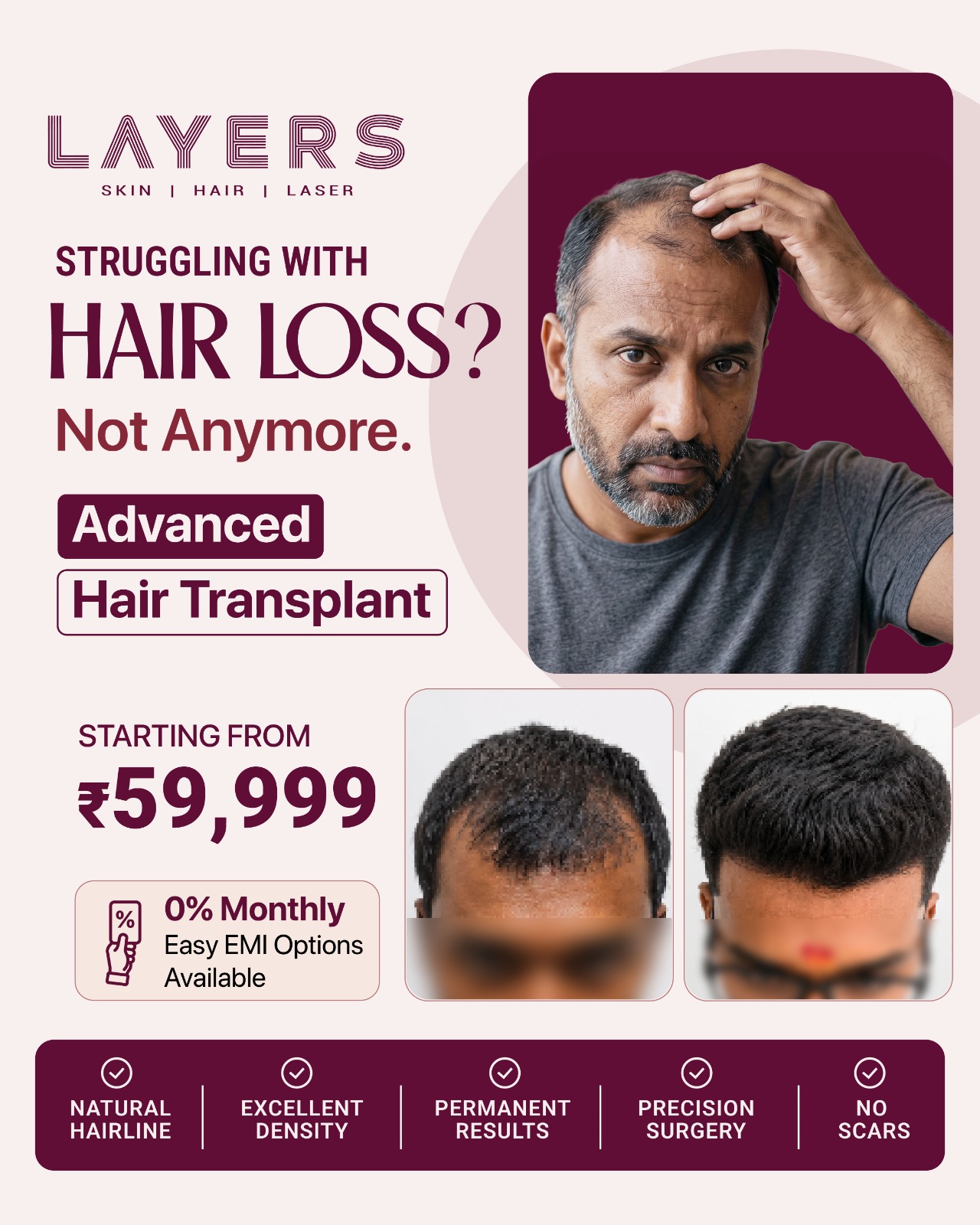Layers Clinics Facebook ad