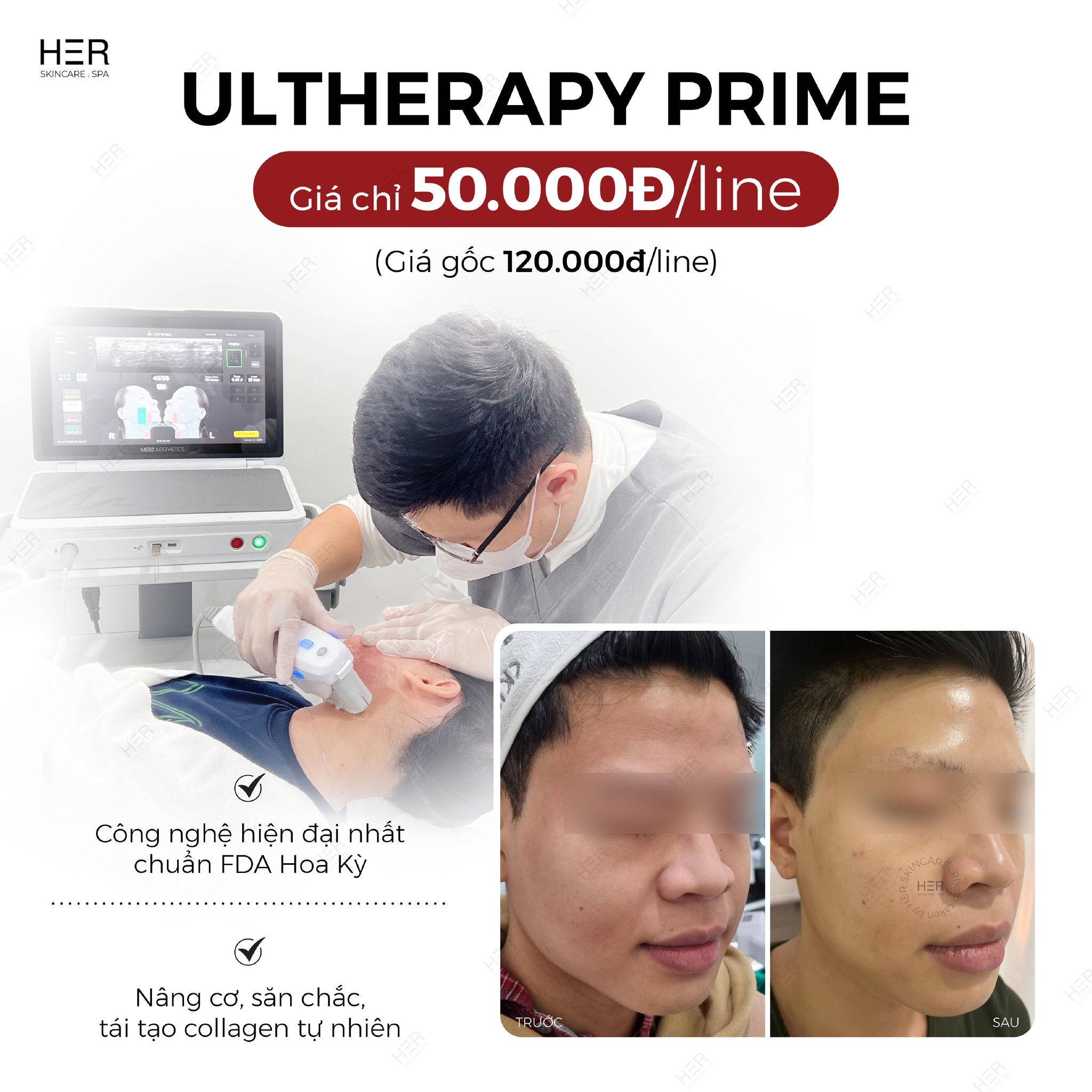 HER Premium Skincare Facebook ad: Chỉ còn 20 suất duy nhất cho chị…