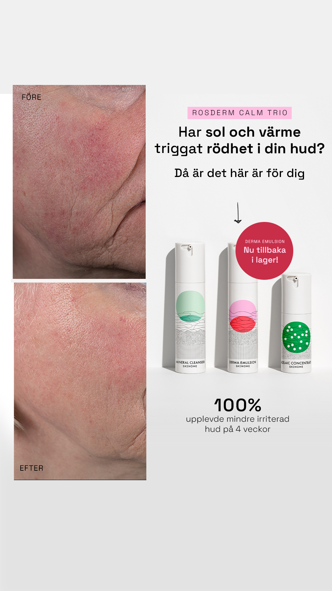 Skinome Facebook ad
