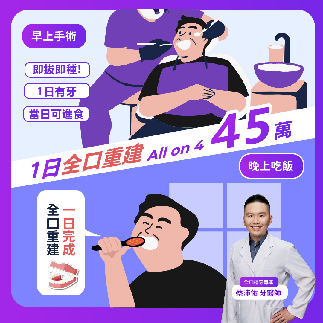 沛然真心 眷佑好牙 全口重建專家蔡沛佑醫師 Facebook ad: 《柏泰牙醫》專科醫師團隊親自諮詢規劃