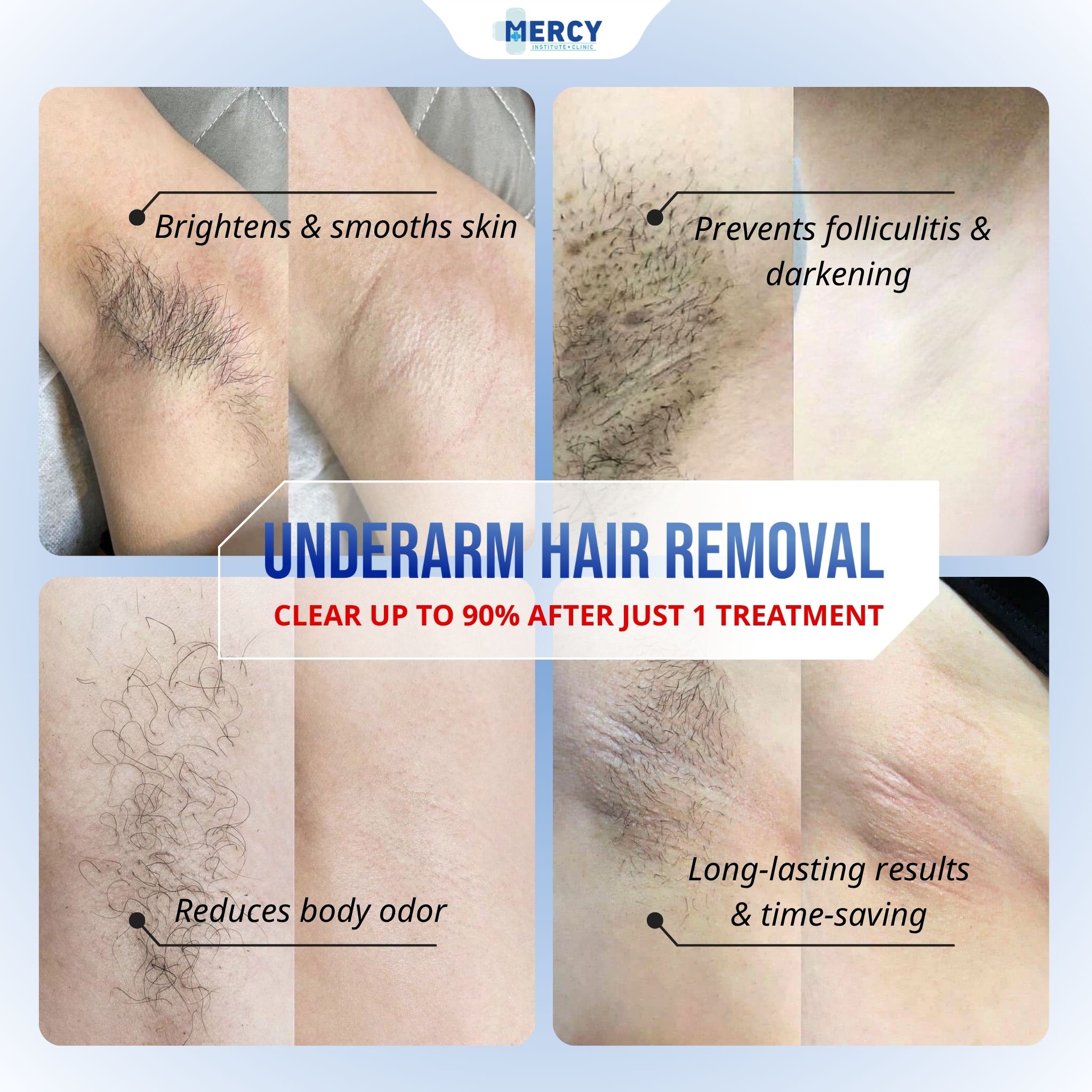Mercy Institute Clinic Facebook ad: Message us now for beautifully smooth skin!