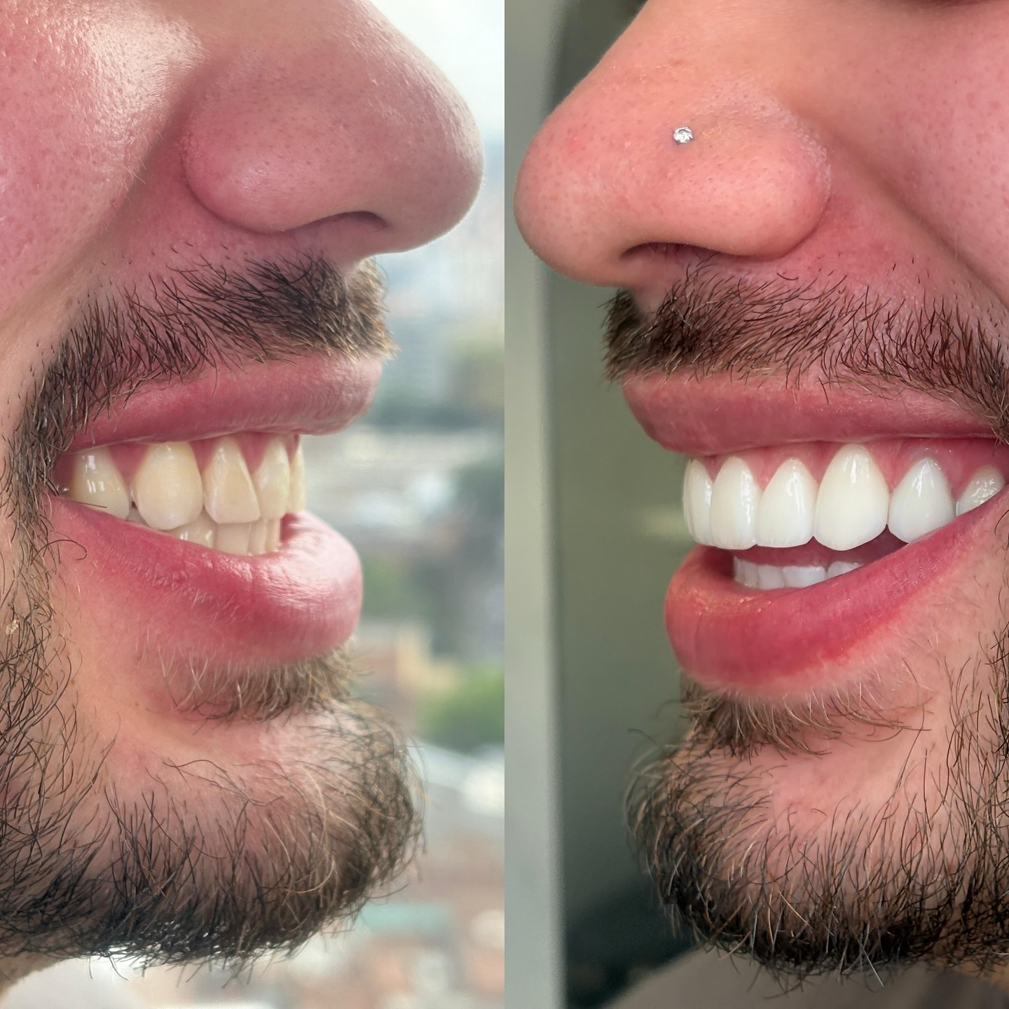 Dr. Smile Colombia Facebook ad