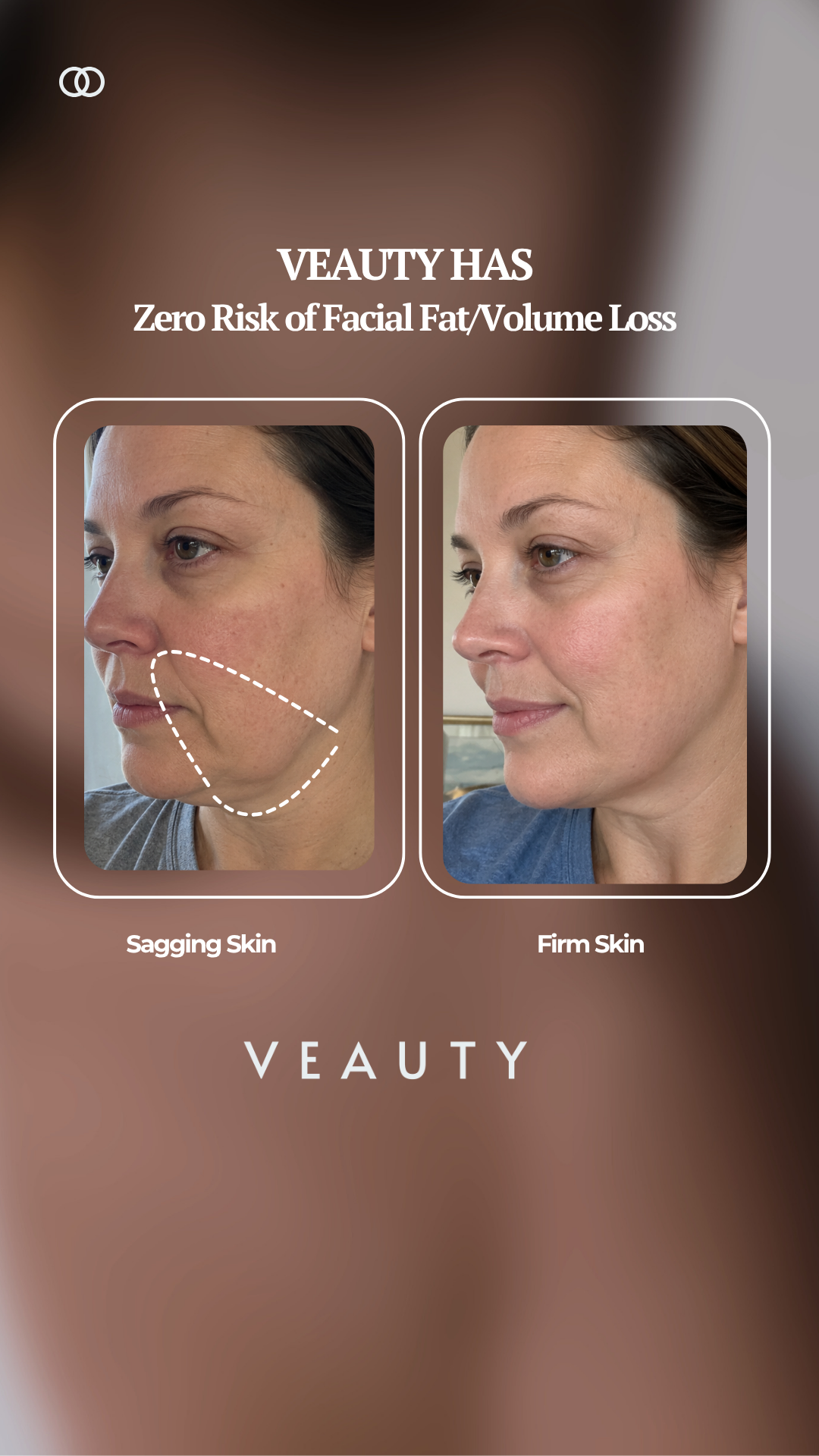 Veauty Facebook ad