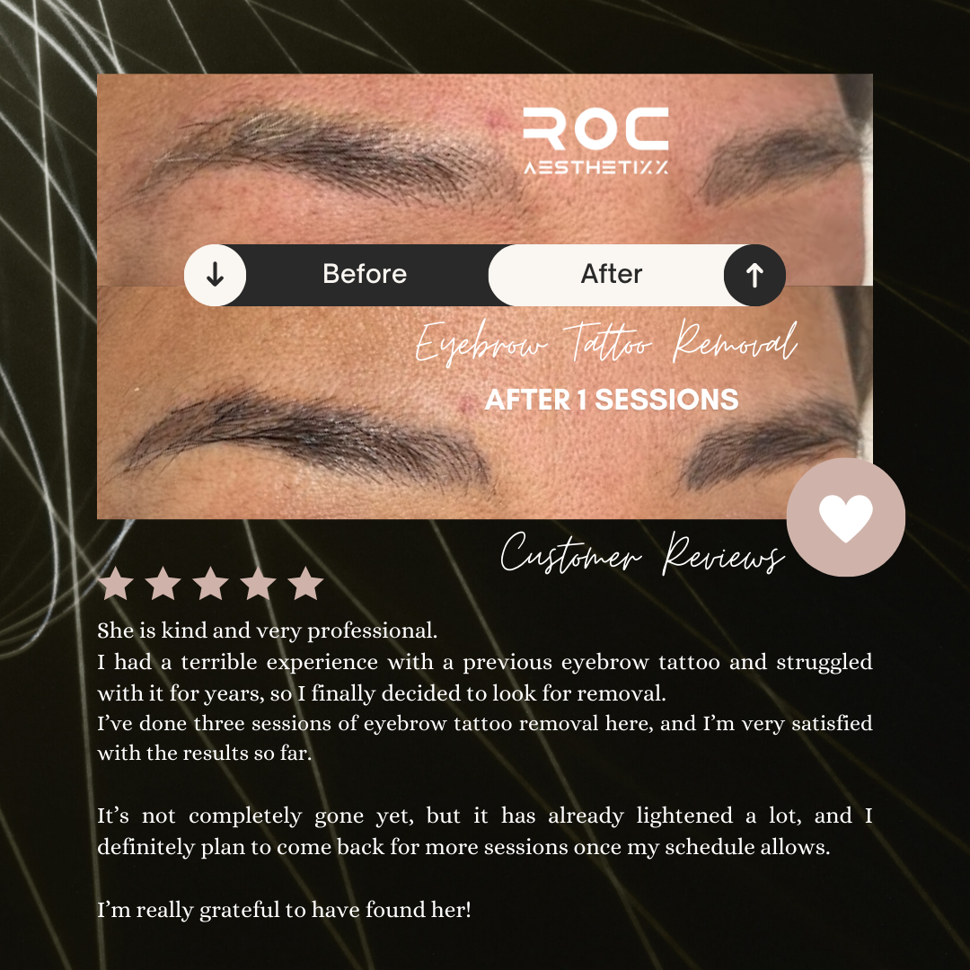 Roc Aesthetics Facebook ad