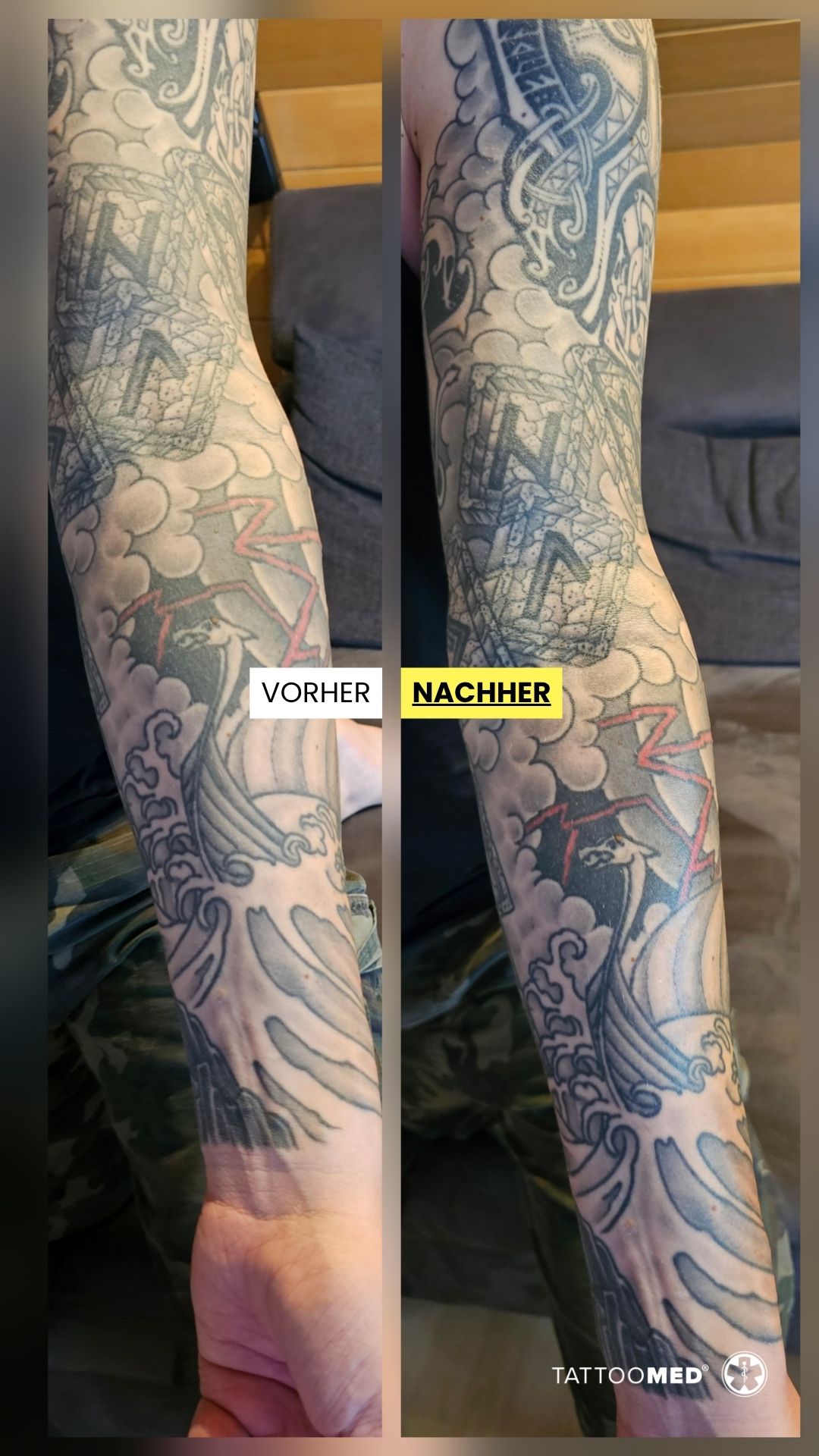 TattooMed Facebook ad