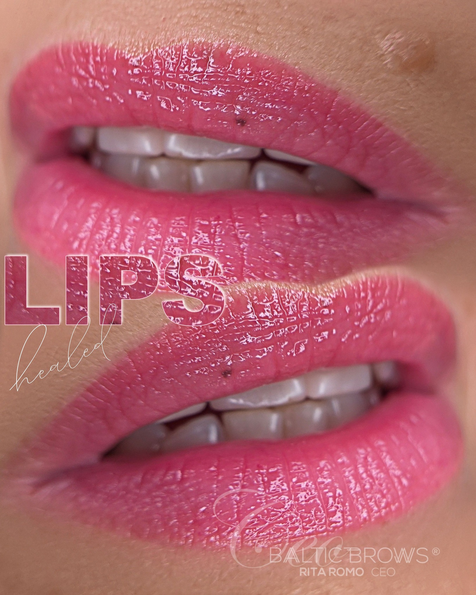 Baltic Brows Facebook ad: Lips micropigmentation healed after 1 session!