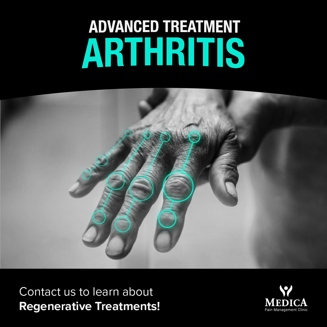 Medica Stem Cells Facebook ad: Most Advanced Orthopedic Treatment in Ireland