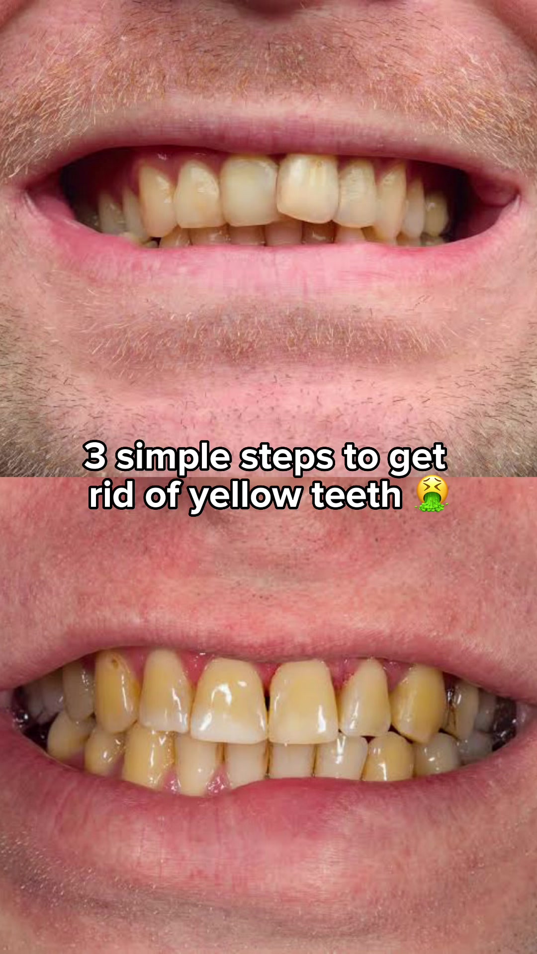 My Sweet Smile Facebook ad: 'The nation's favourite tooth whitener' - The Guardian