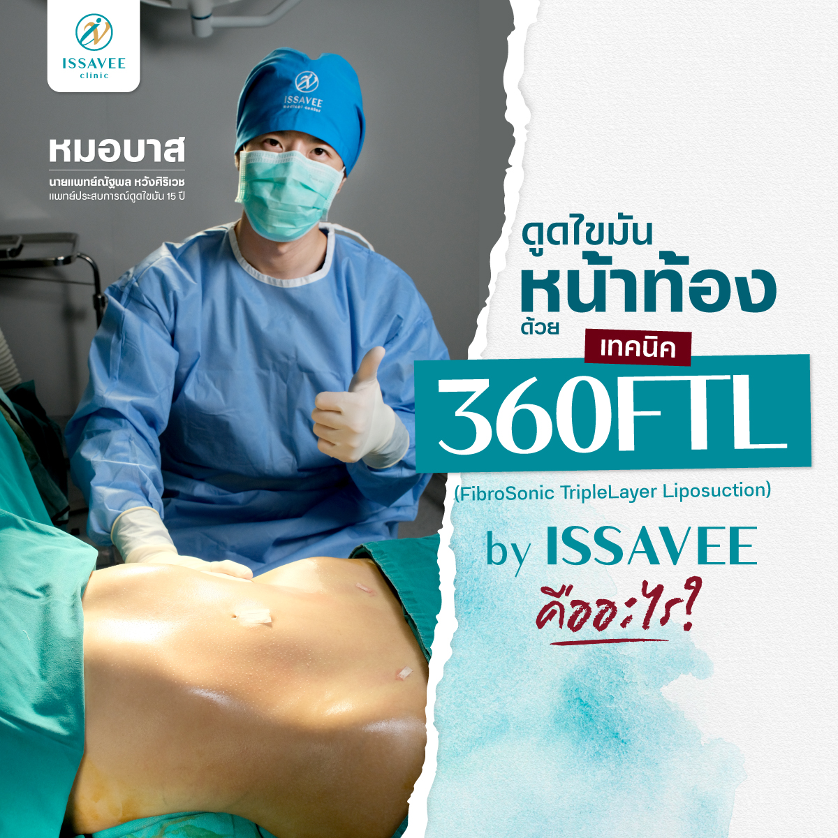 ดูดไขมัน 360 FTL by Issavee Clinic Facebook ad