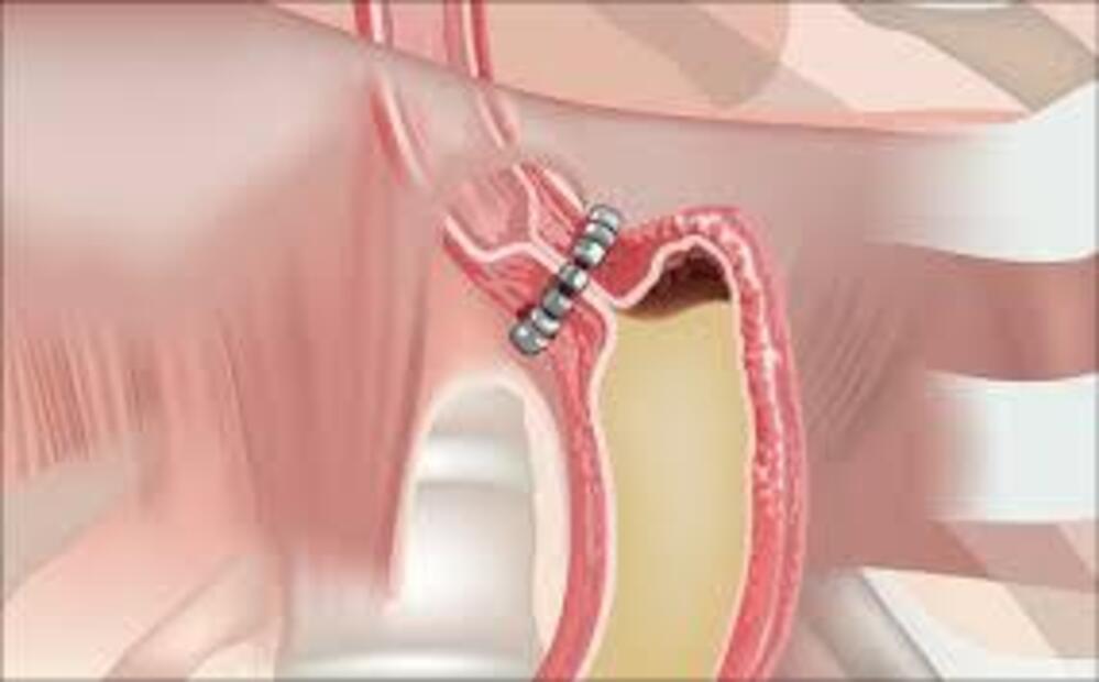Dr. Patricia Moore PhD Facebook ad: They Treated Symptoms, Not Cause