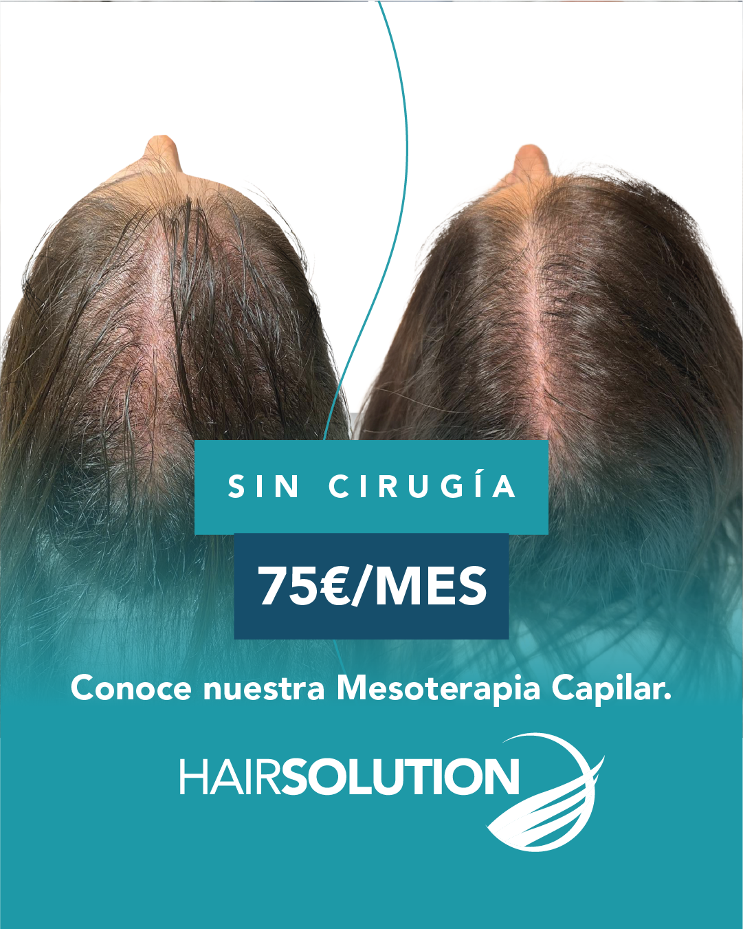 Hair Solution Facebook ad