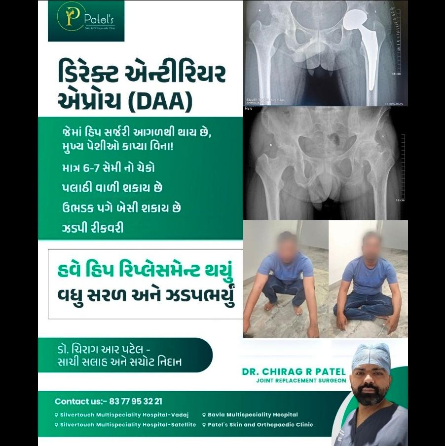 Dr Chirag R Patel Orthopedic and Joint Replacement surgeon Facebook ad: Best Direct Anterior Approach Hip Replacement Center in…