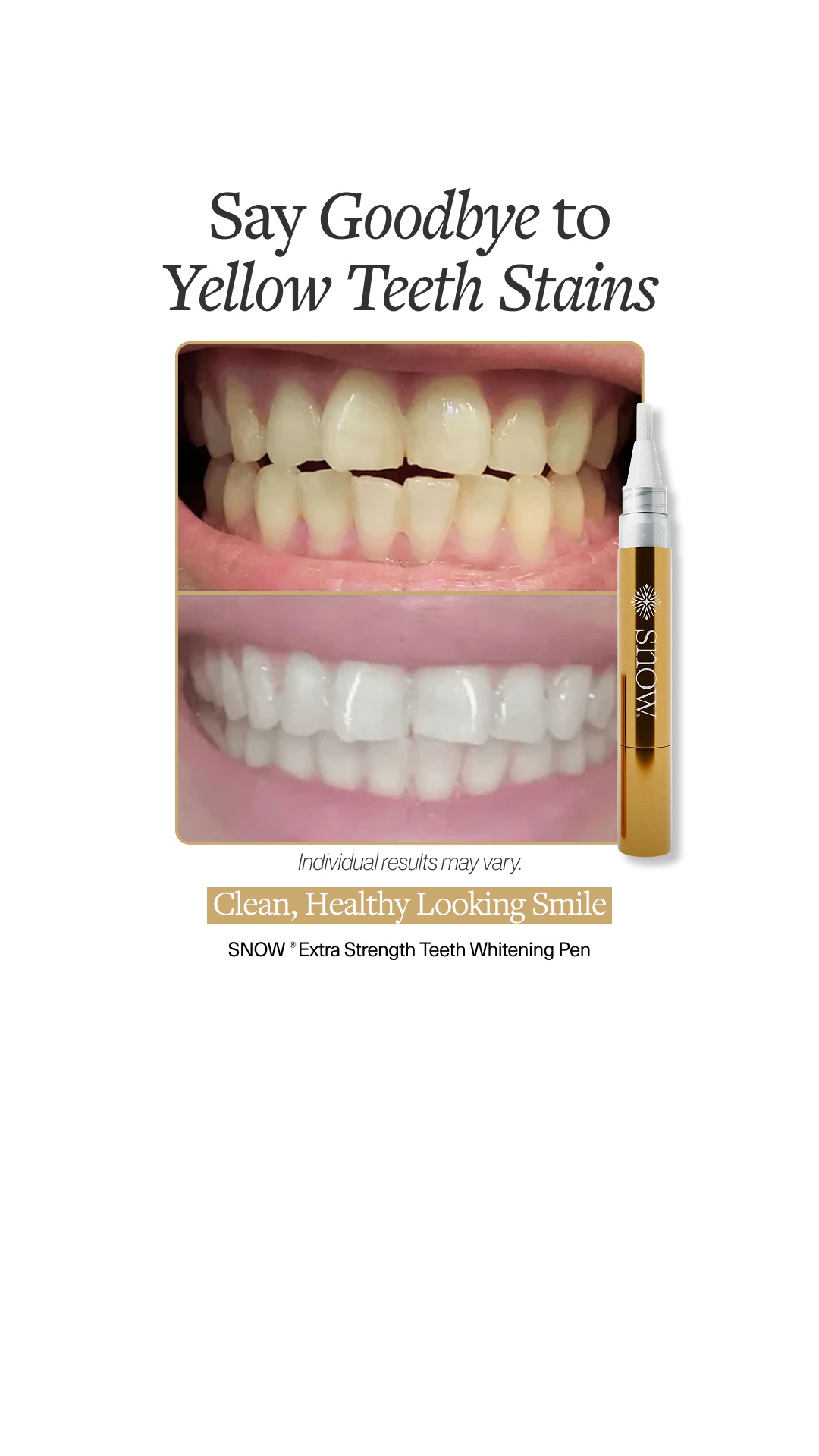 SNOW Teeth Whitening Facebook ad