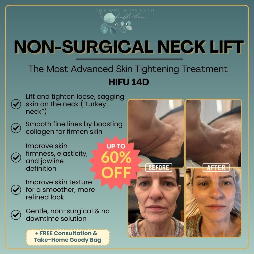 The Wellness Path Facebook ad: Non-Surgical Necklift - Just £149