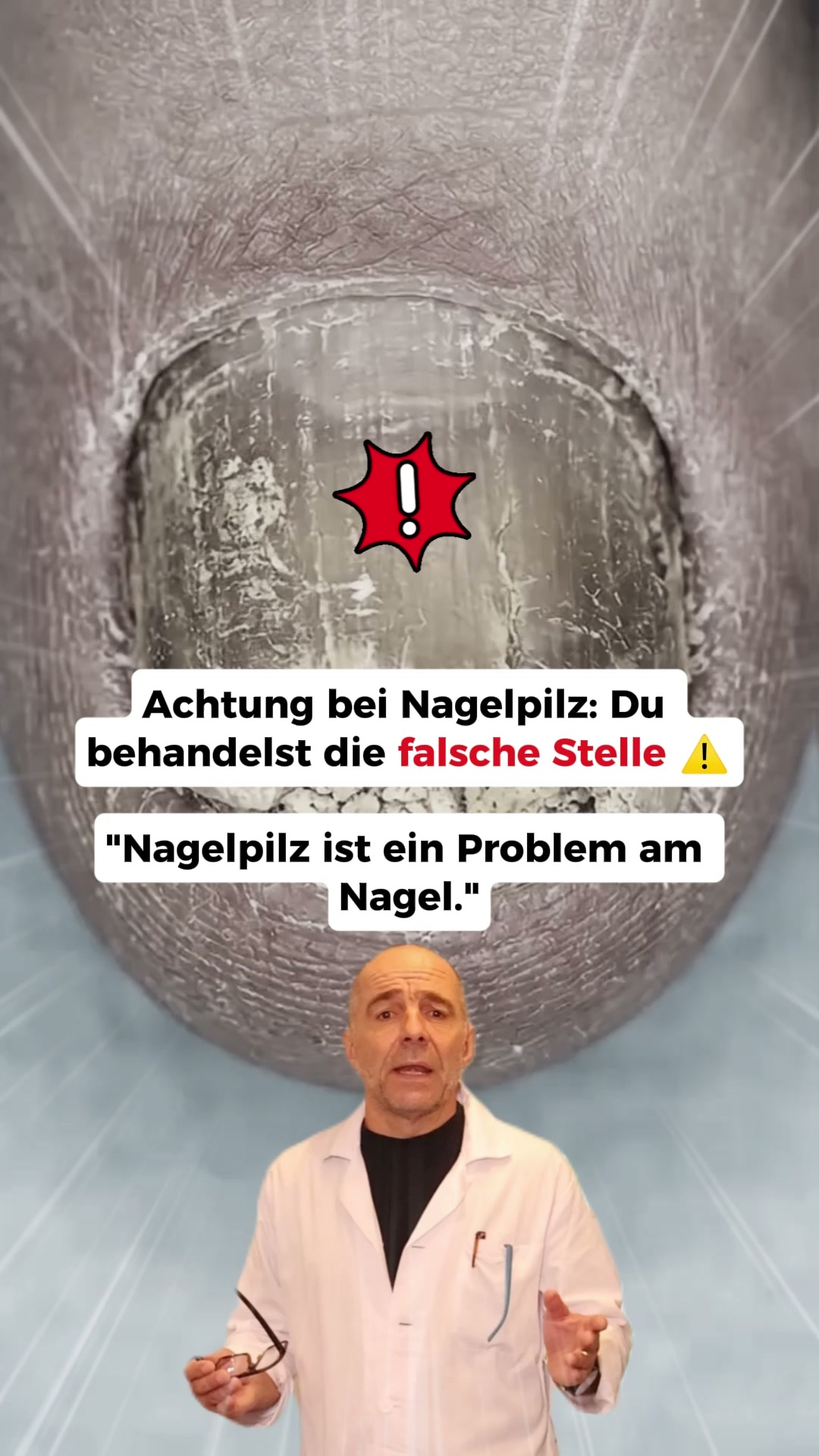 Nagelpilz Ratgeber Facebook ad: Der größte Fehler bei Nagelpilz