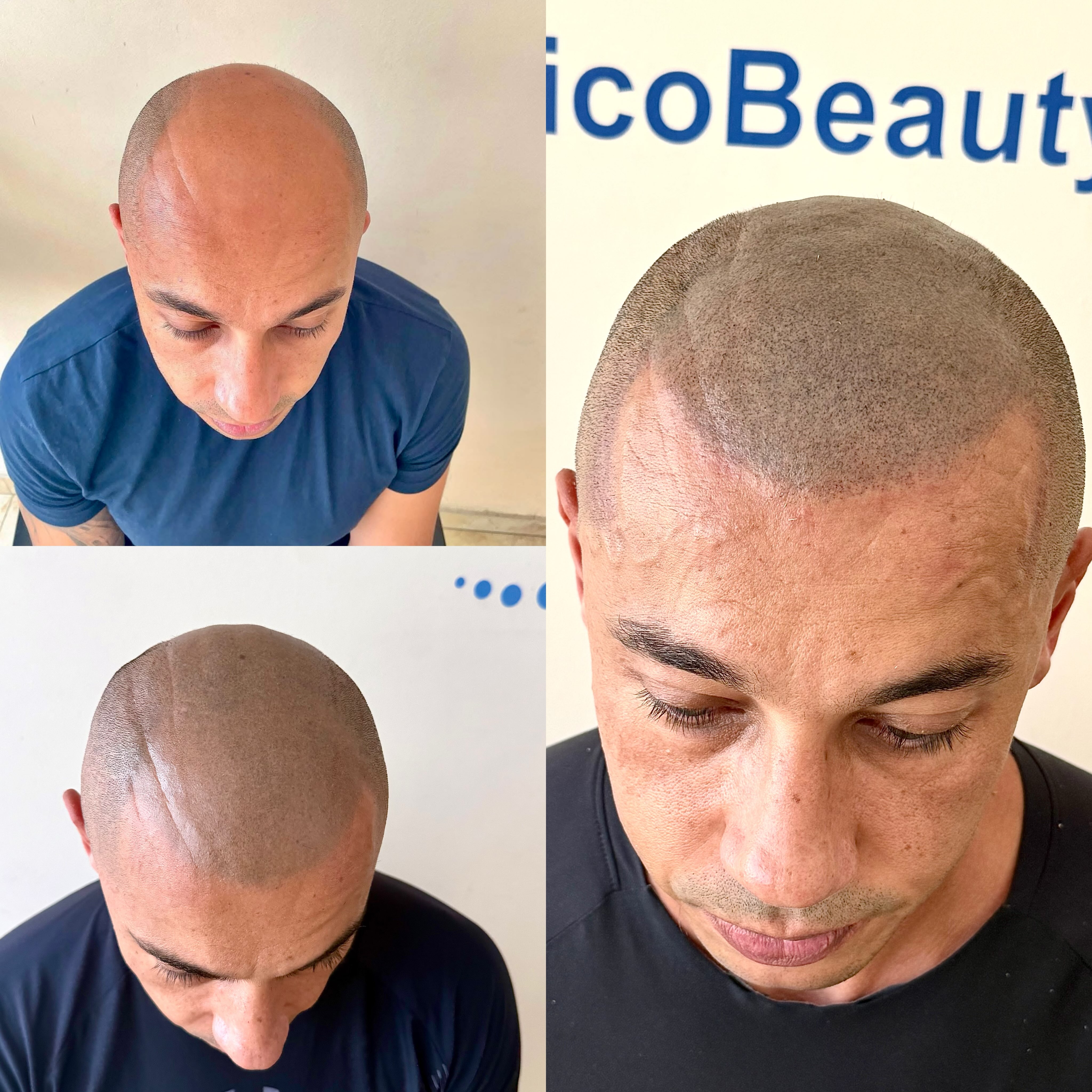Michele Partipilo Trico Beauty Canarias Facebook ad: Mantenimiento SMP