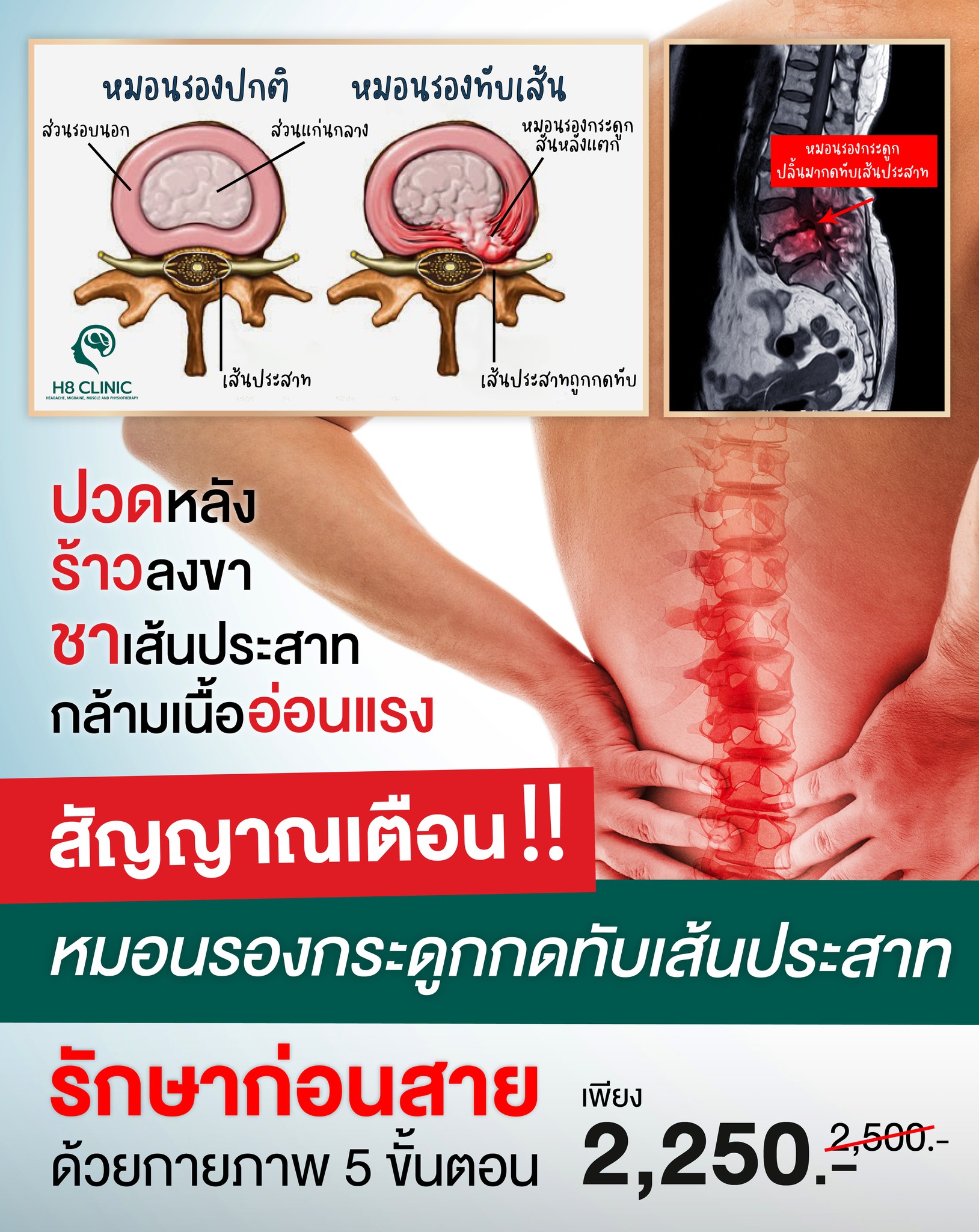 H8 clinic คลินิกสมอง ปวดศีรษะ ไมเกรน ปวดกล้ามเนื้อ Facebook ad