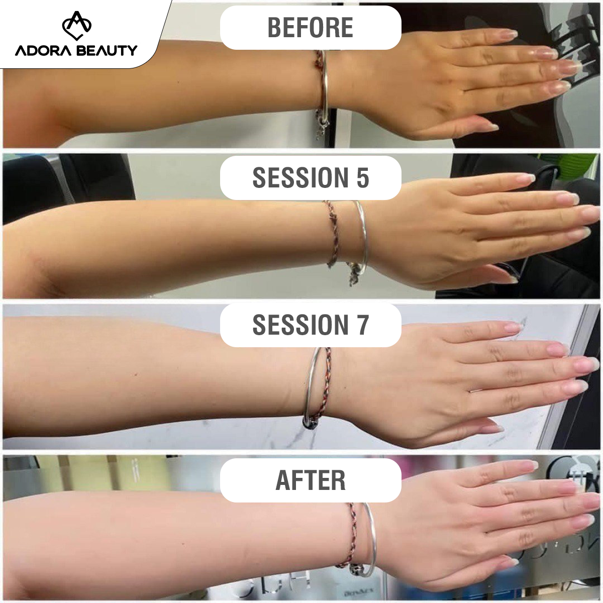 ADORA Beauty Clinic - Glow With A Luminous Pink And White Skin Facebook ad