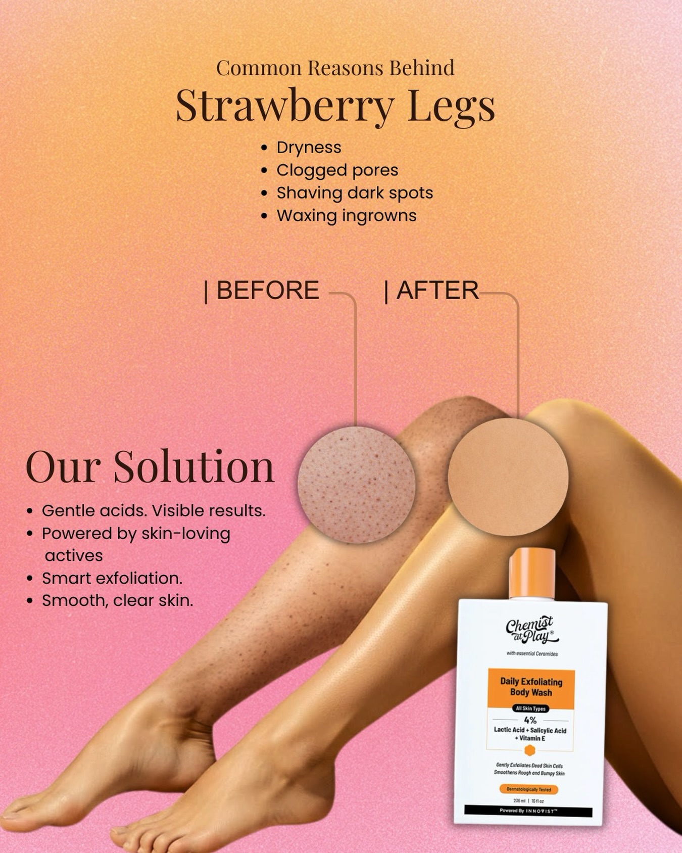 Chemist At Play Nepal Facebook ad: Dryness.clogged pores.Dark spots after saving?