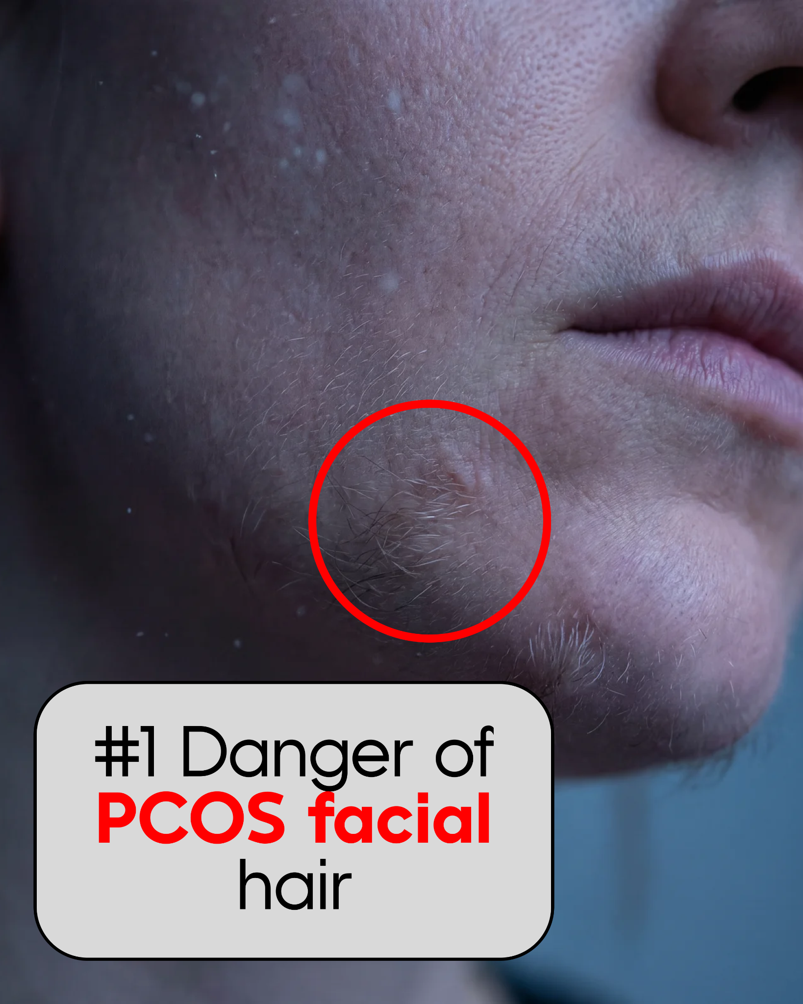 The PCOS Doctor Facebook ad